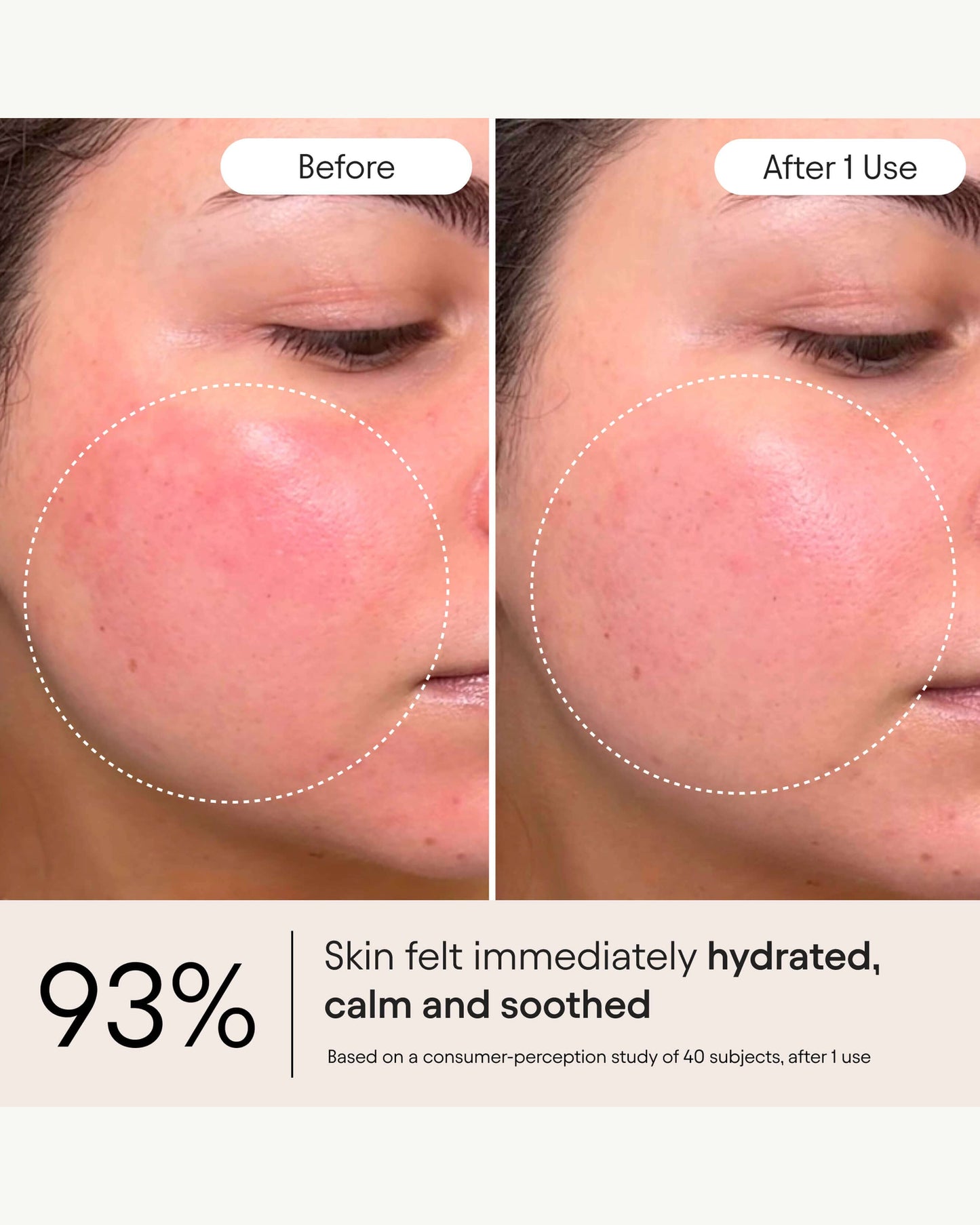 Barrier Repair Cream Moisturizer for Eczema, Barrier and Wrinkle Repair