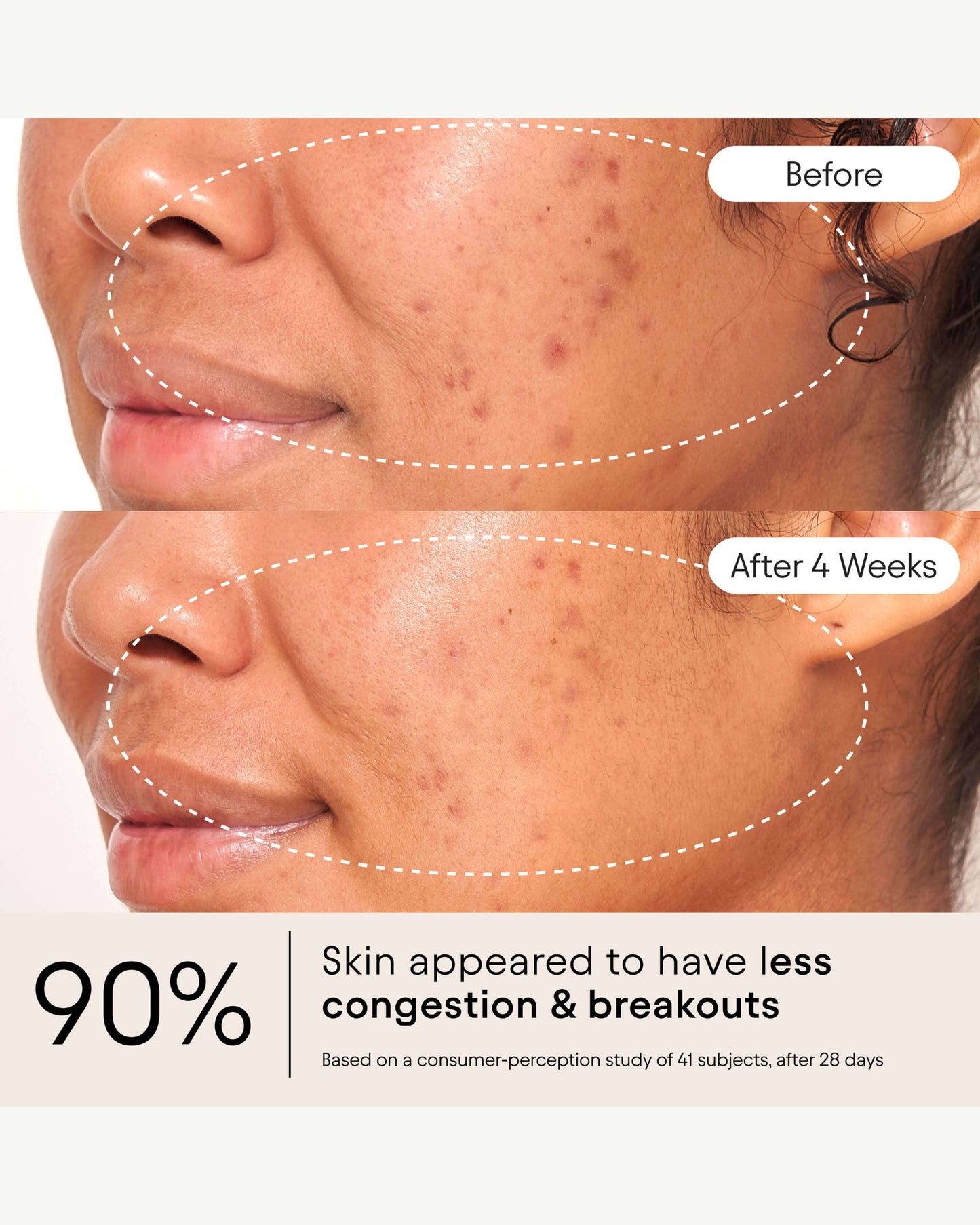 Clarifying Facial Oil with Retinol & Pink Algae