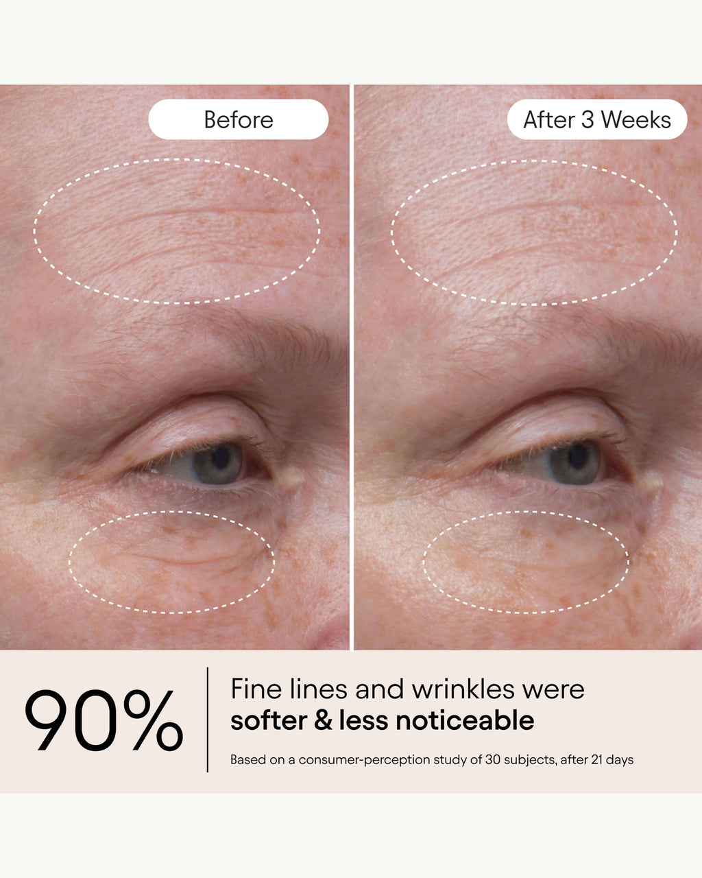 Hydrating Firming Serum with Niacinamide & Nettle