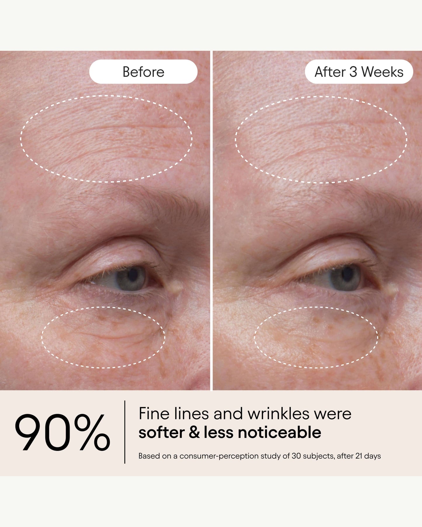 Hydrating Firming Serum with Niacinamide & Nettle
