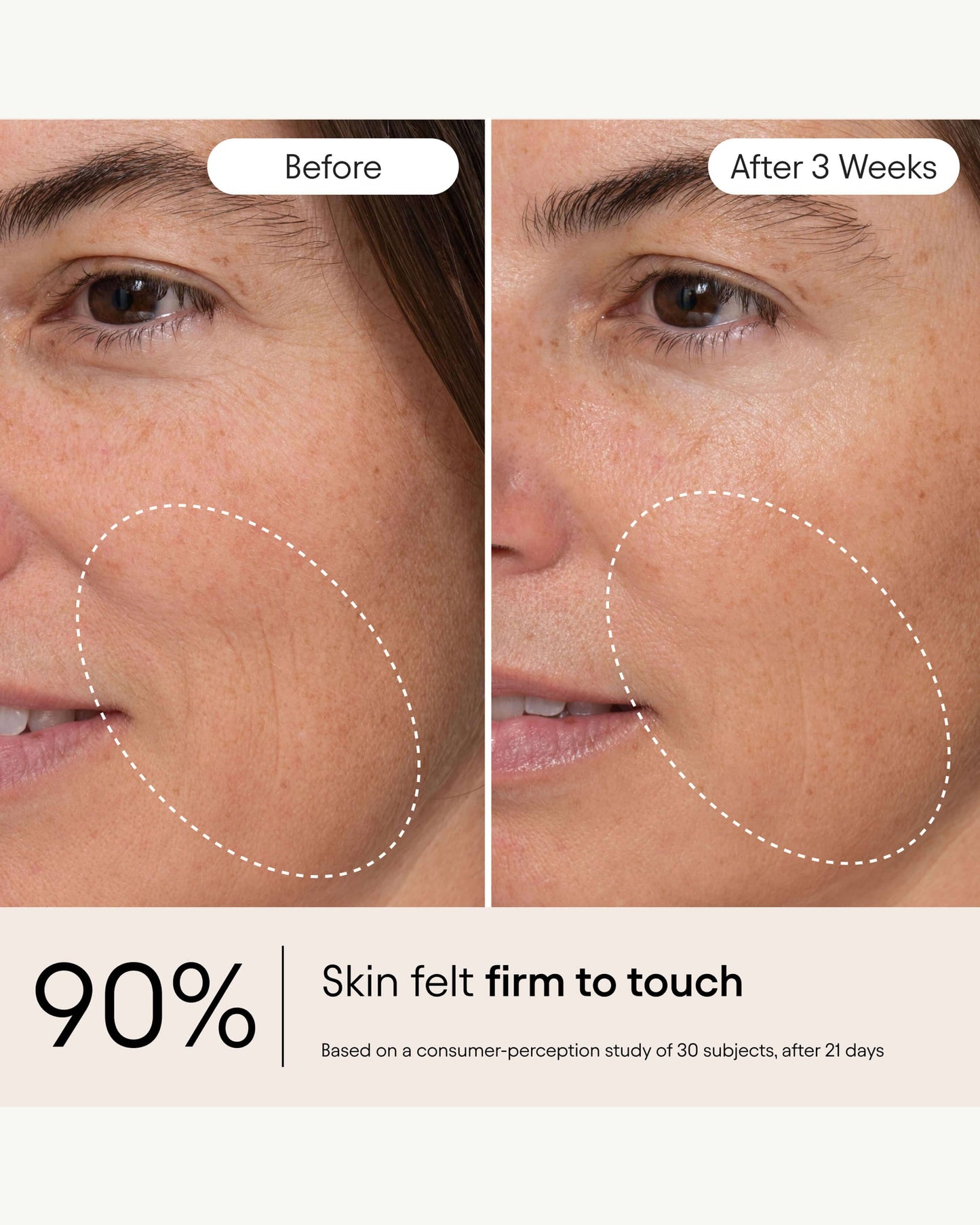 Hydrating Firming Serum with Niacinamide & Nettle