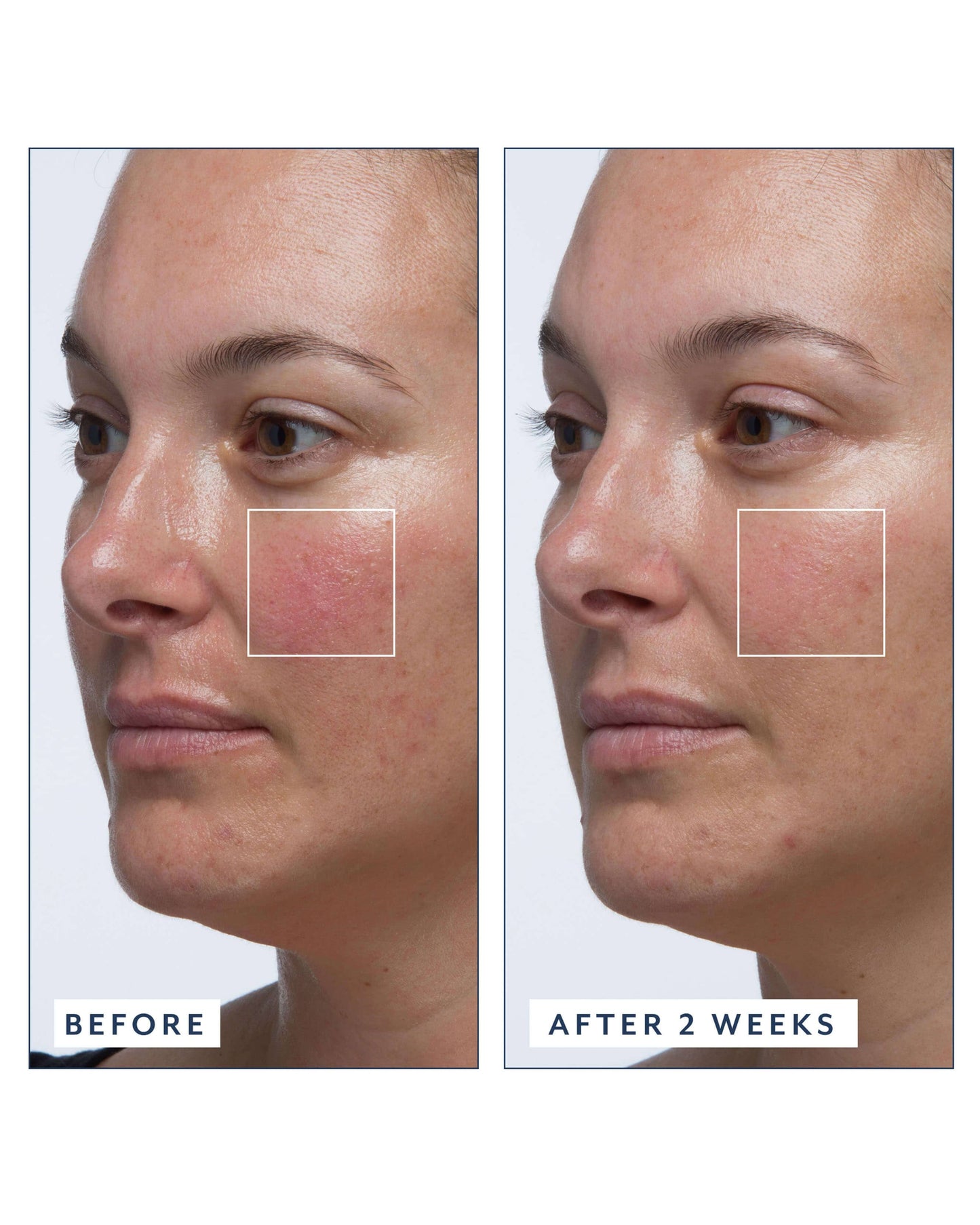 Royal Tulip Vitamin C Facial Oil
