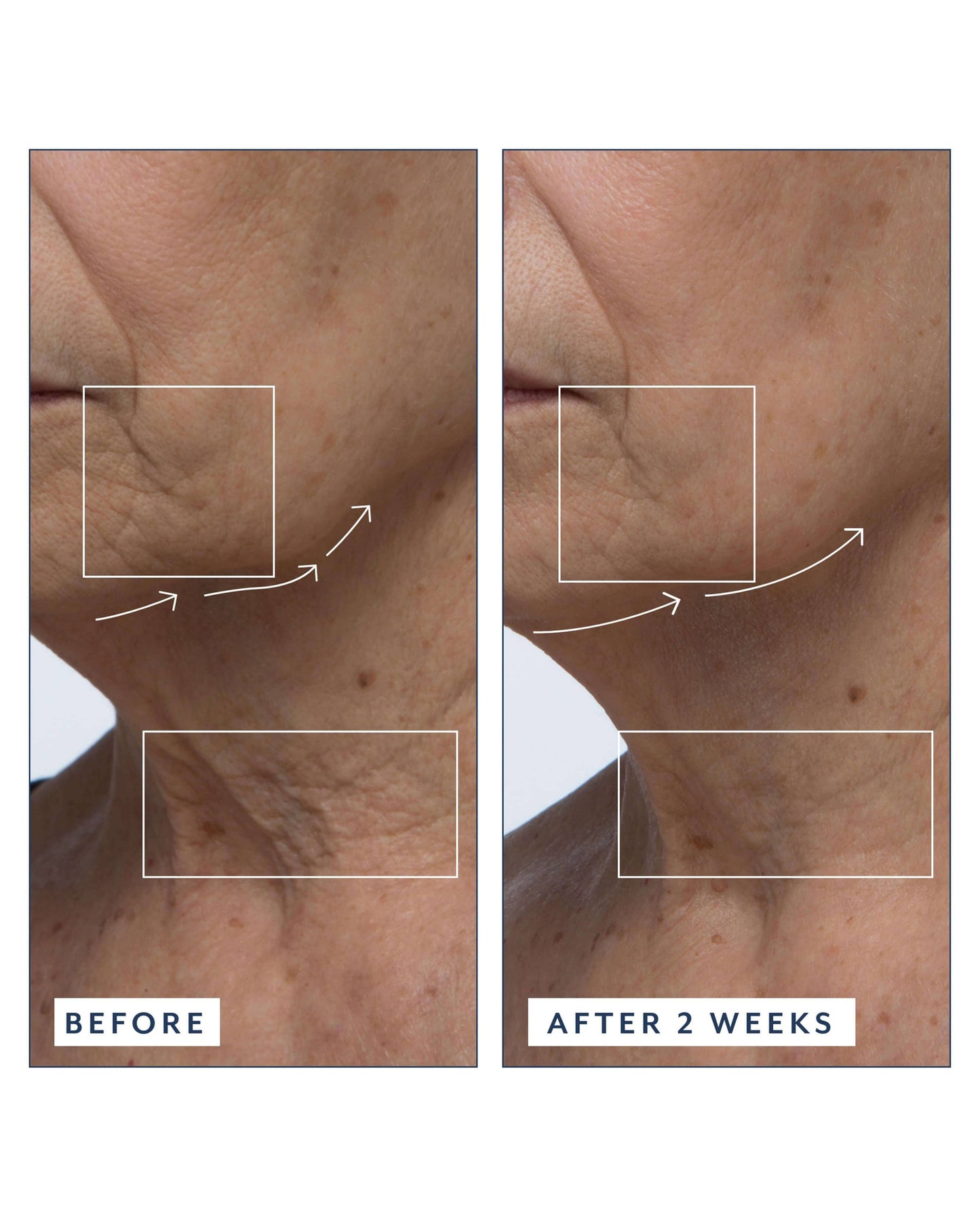 Royal Tulip Vitamin C Facial Oil