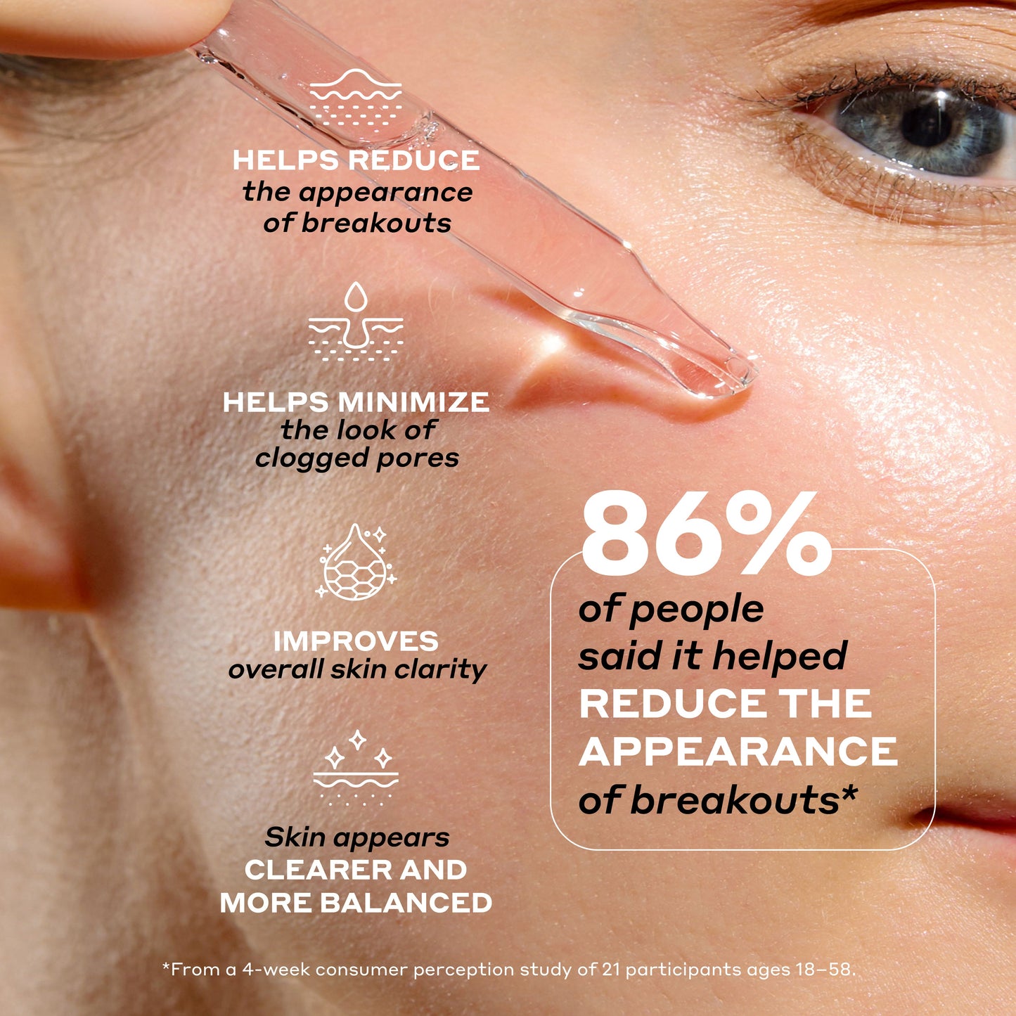 Clarifying Serum with Azelaic Acid