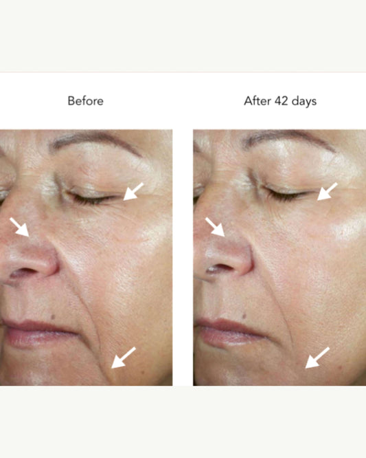 DNA-42 Clinicalift Serum