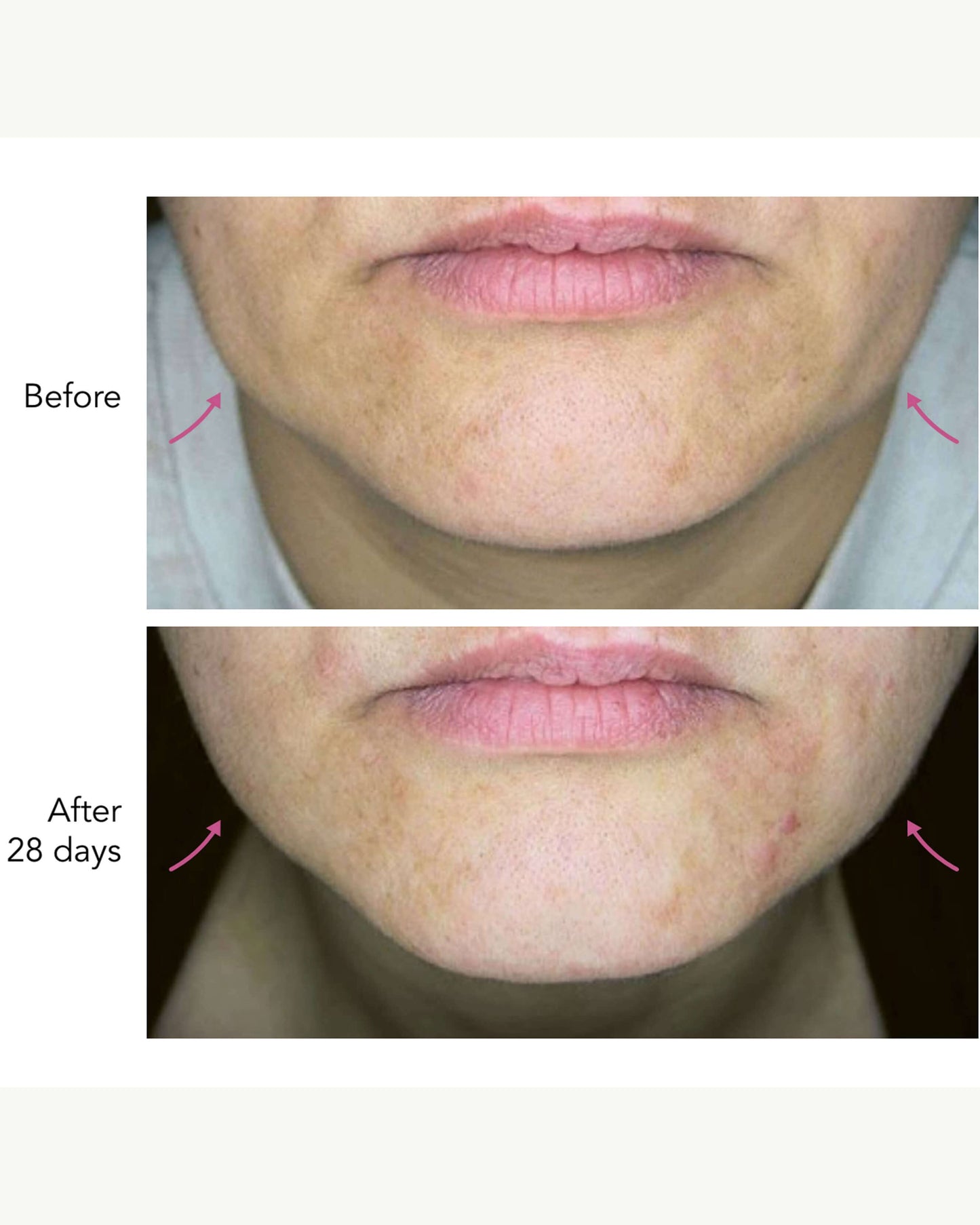DNA-42 Clinicalift Serum