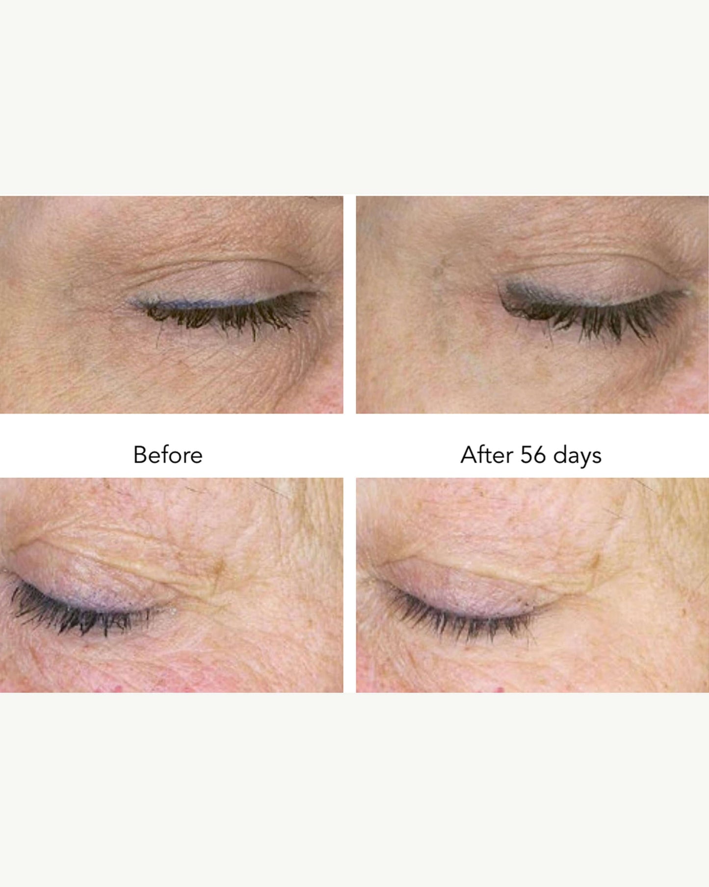 DNA-42 Clinicalift Serum