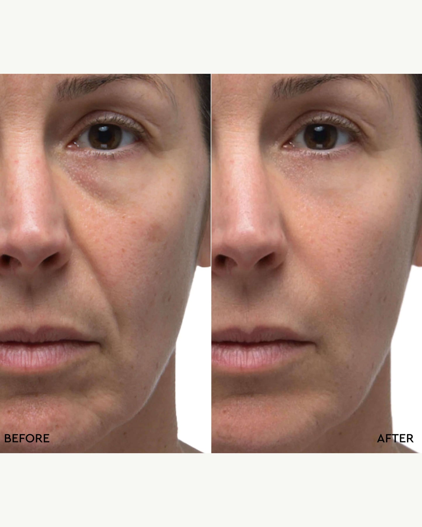 Retinol Rescue Overnight Cream