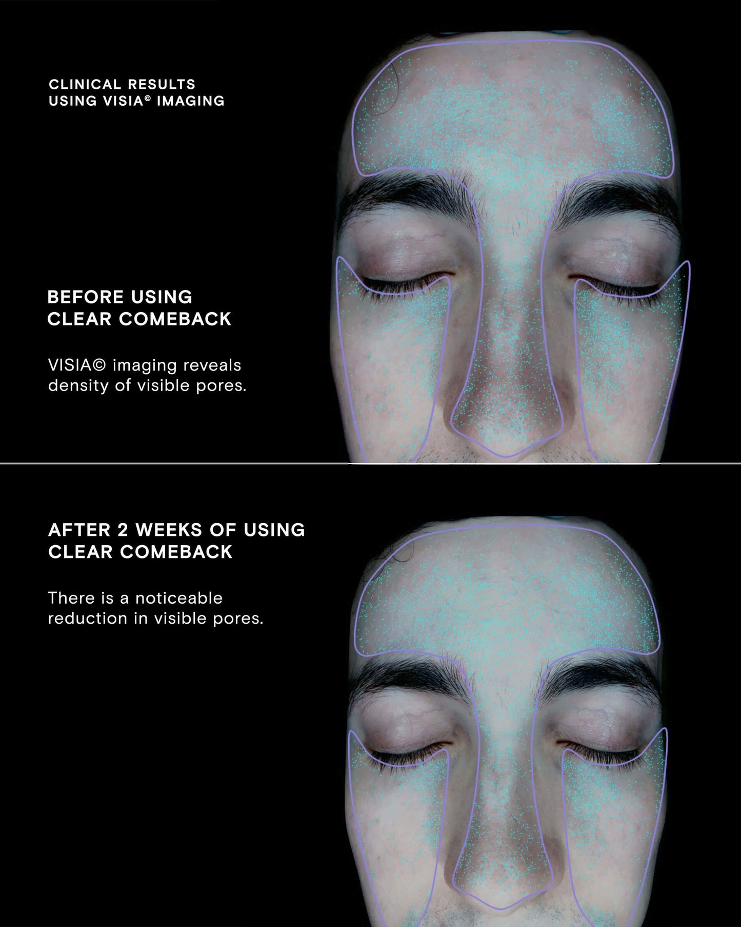 Clear Comeback Probiotic Enzyme Powder Refill