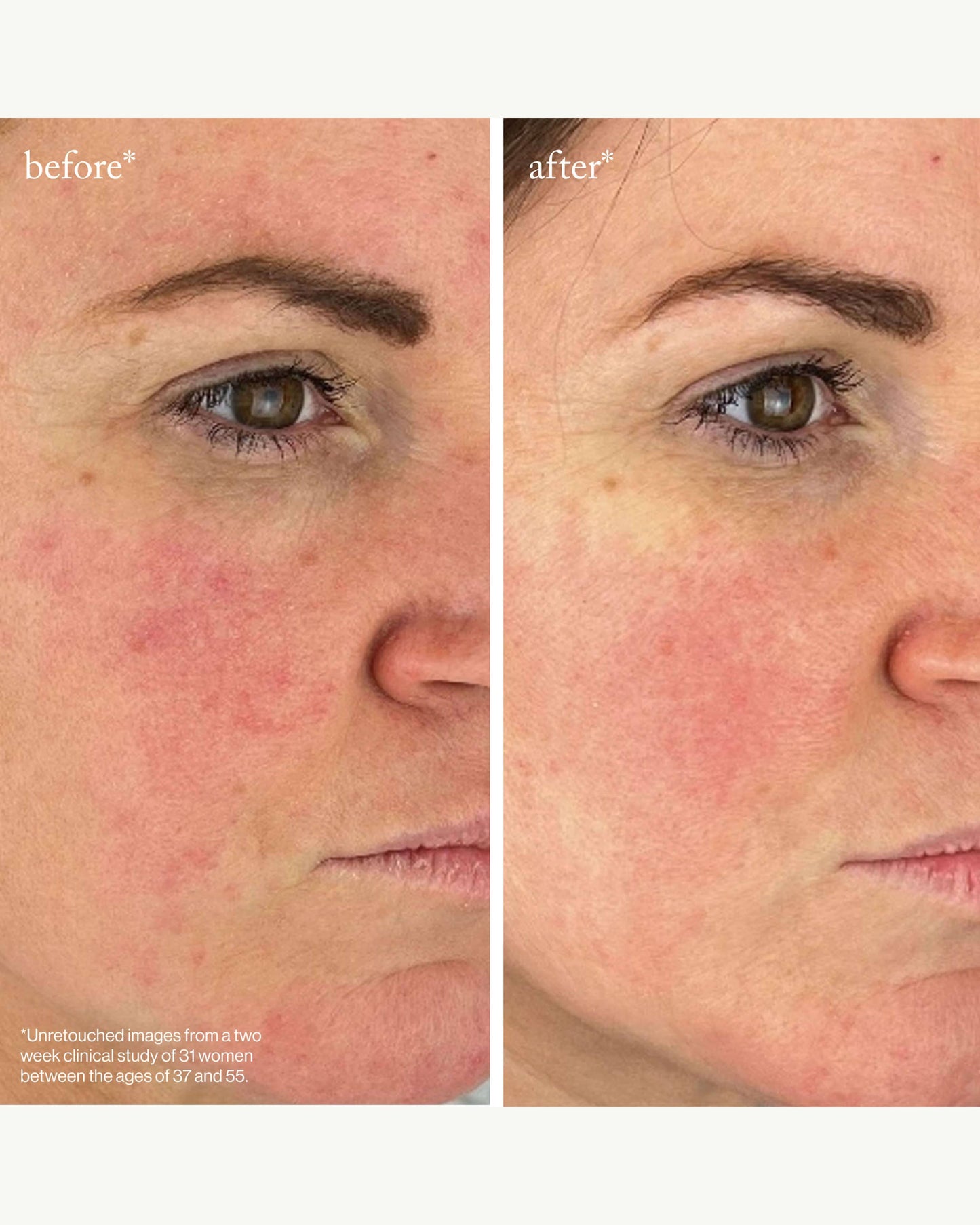 Youth-Boost Peptide Serum