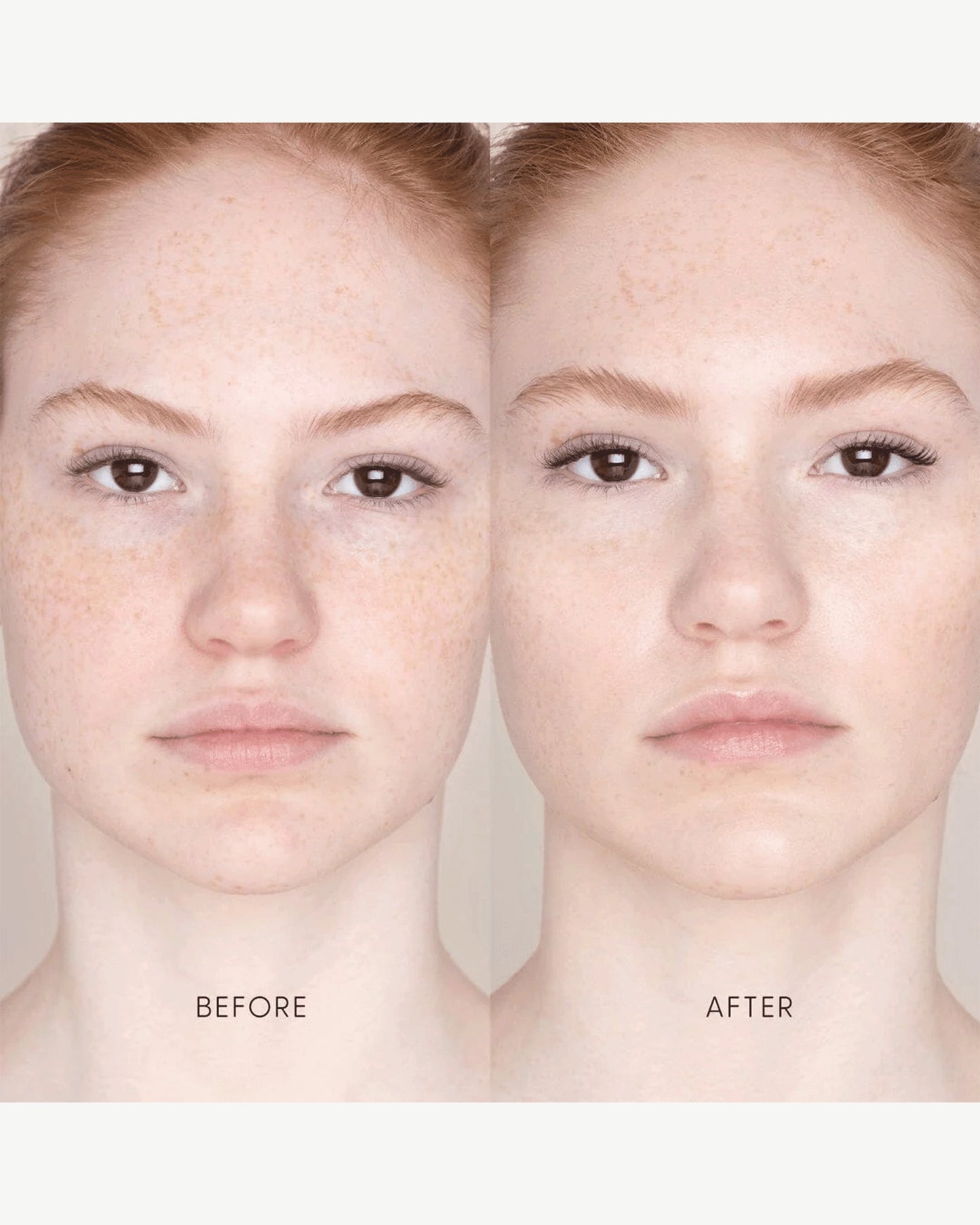 Best Skin Days Treatment Concealer