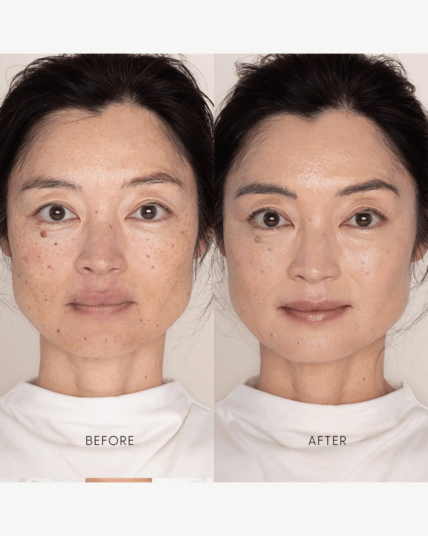 Best Skin Days Treatment Concealer
