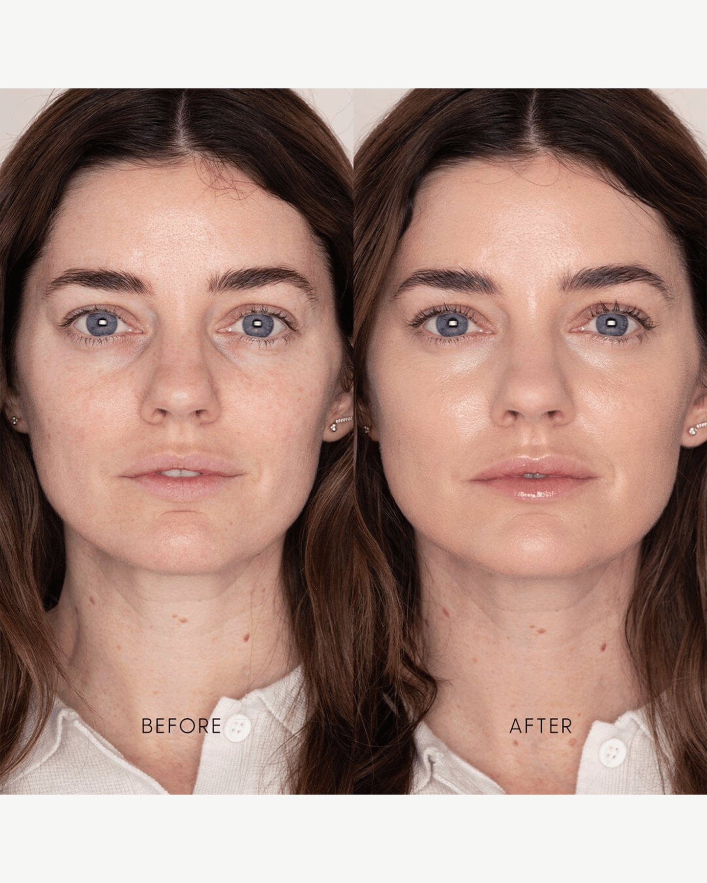 Best Skin Days Treatment Concealer
