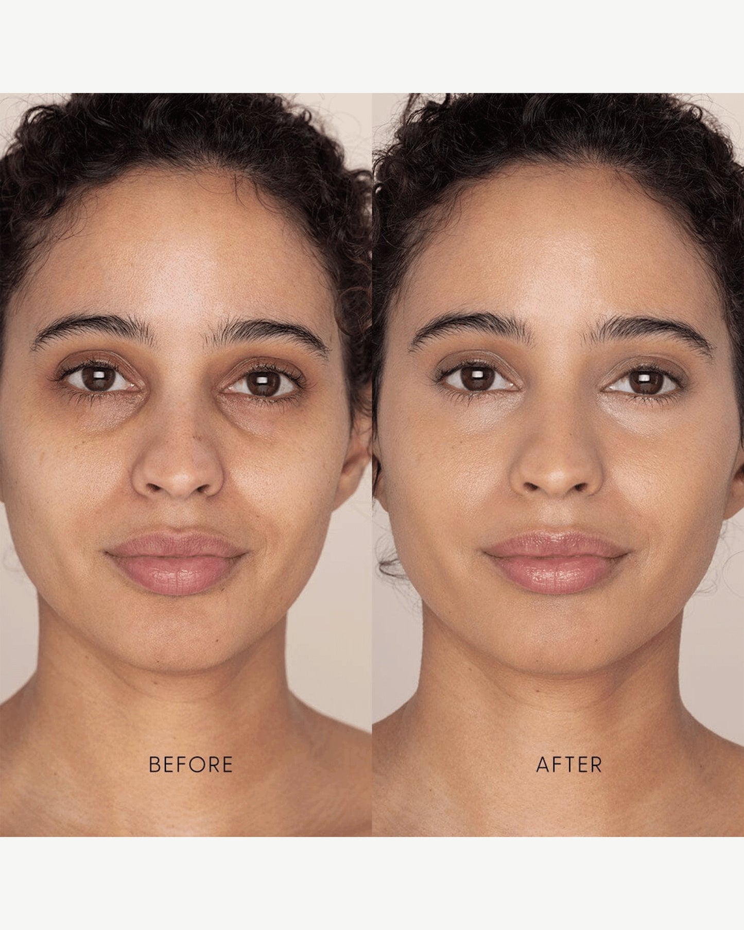 Best Skin Days Treatment Concealer