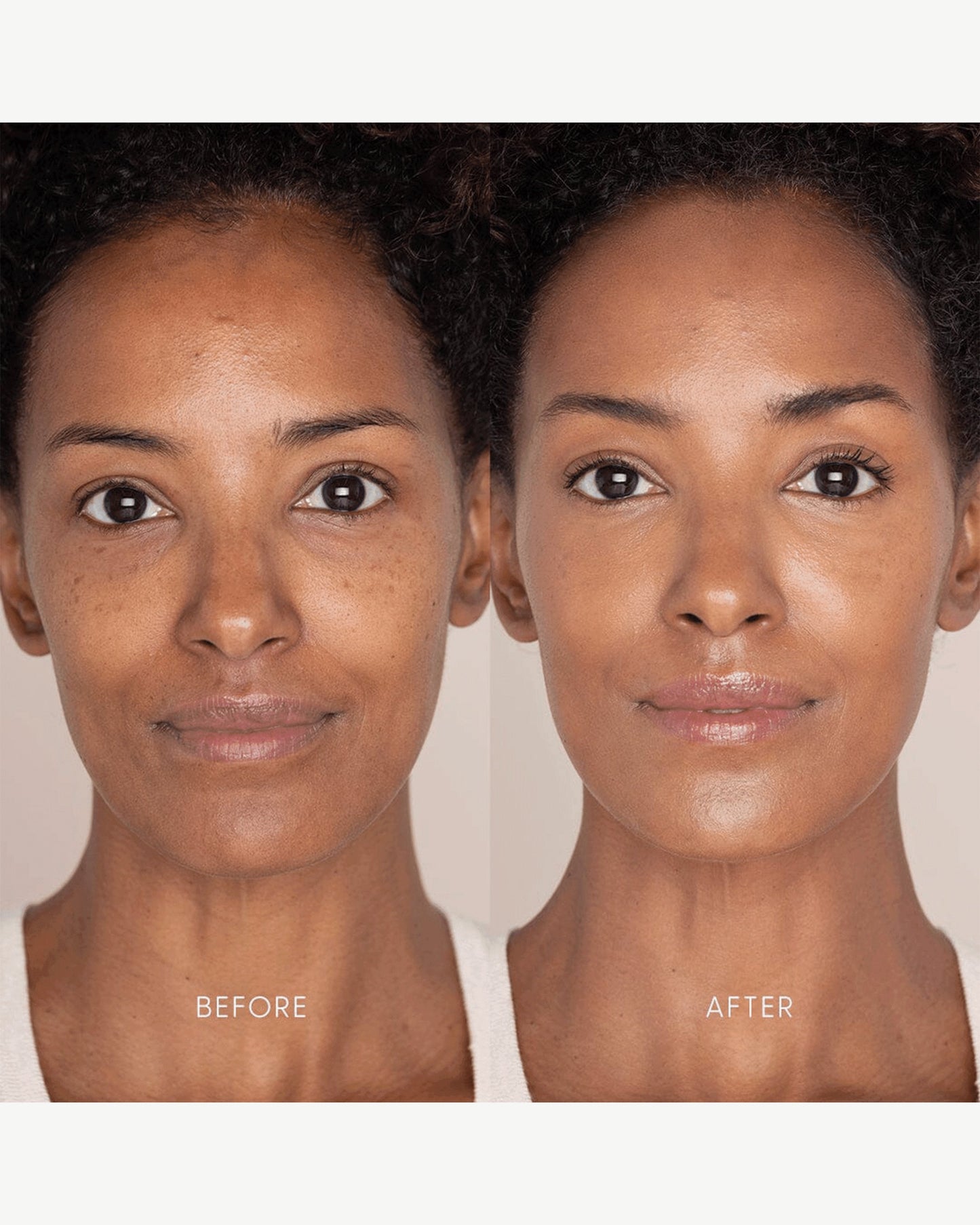 Best Skin Days Treatment Concealer