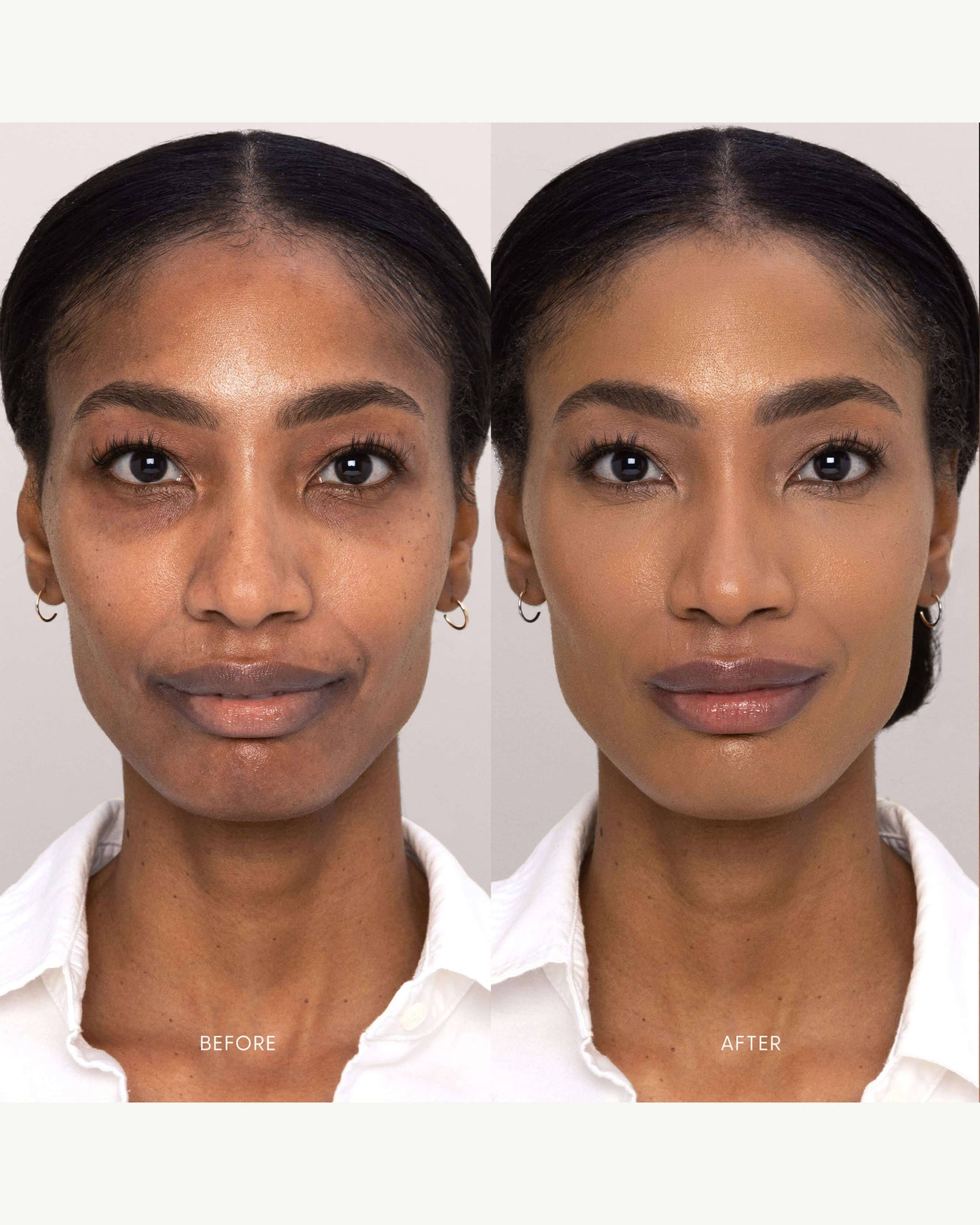 Best Skin Days Treatment Concealer
