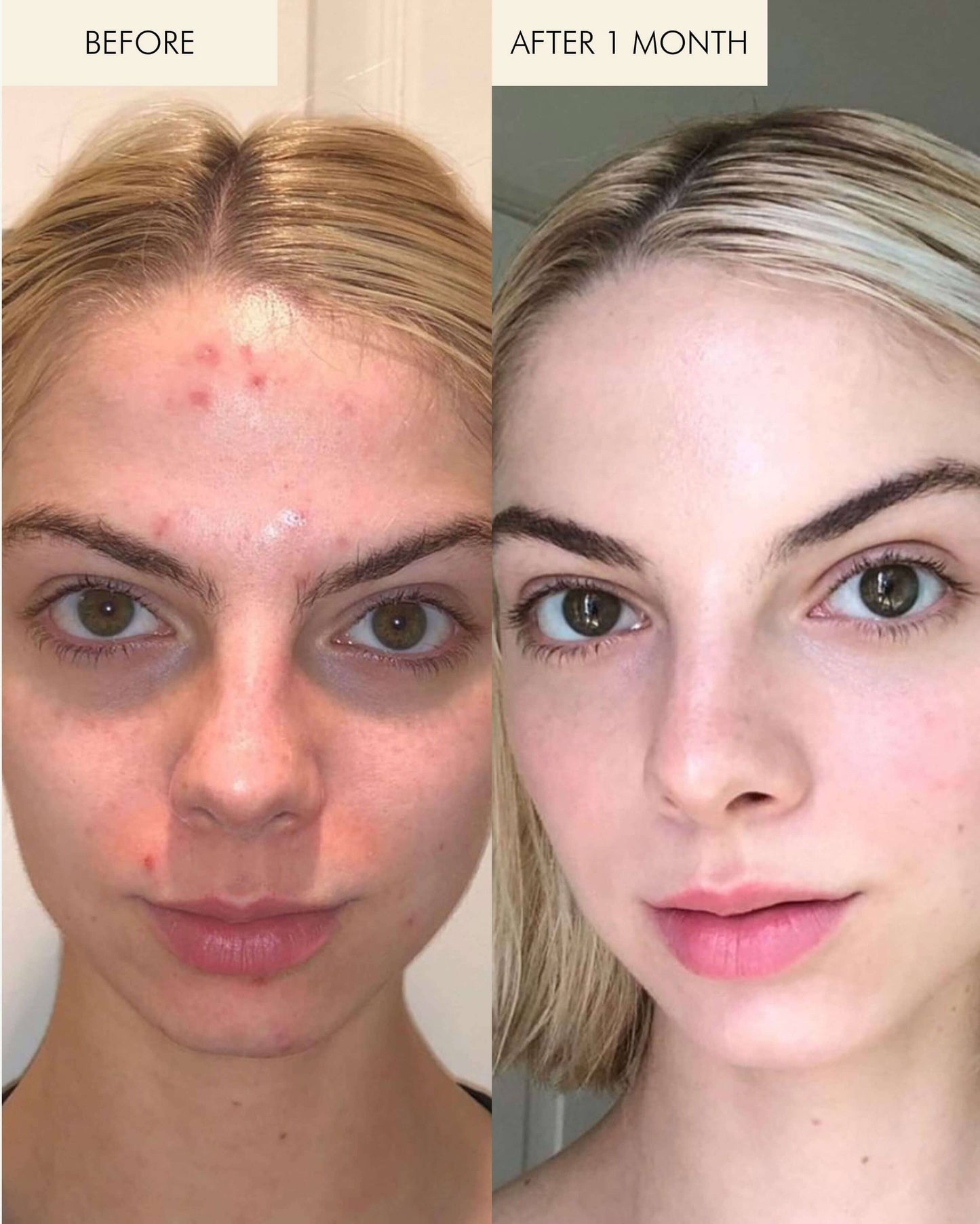 1.2% Clean Algae Retinol Face Oil for Anti-Aging and Wrinkles with Green Tea