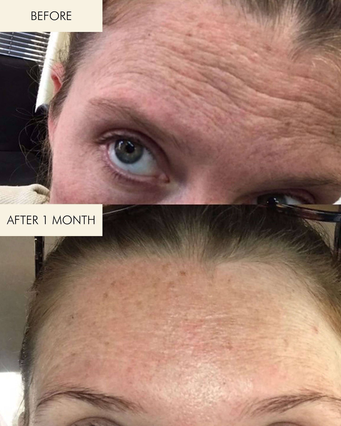 1.2% Clean Algae Retinol Face Oil for Anti-Aging and Wrinkles with Green Tea