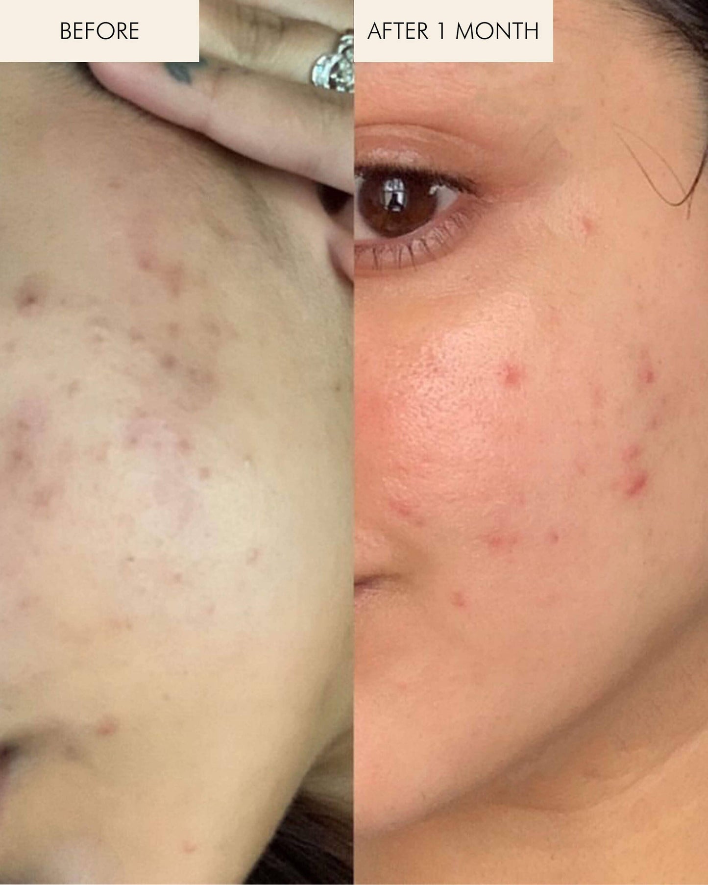 Sea Vitamin C Serum for Brightening Dark Spots & Redness with Algae