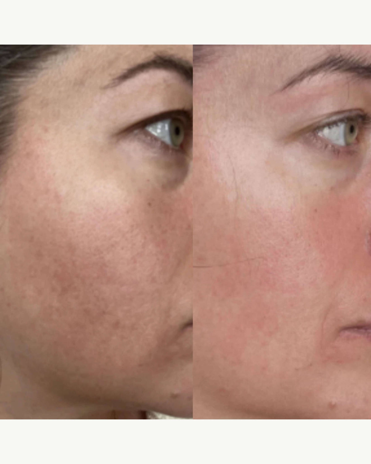 The Meringue Melt Regenerating Skin-Softening Cleanser