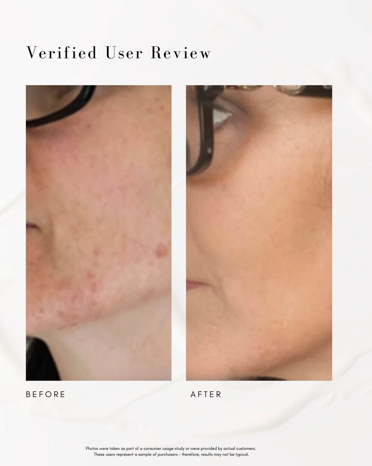 Le Sérum Retinol Doux Avancé Straight A