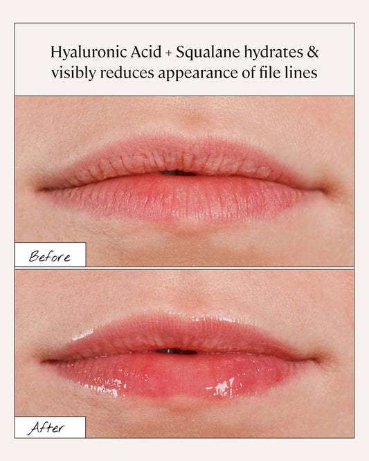 Squalane + Hyaluronic Lip Serum