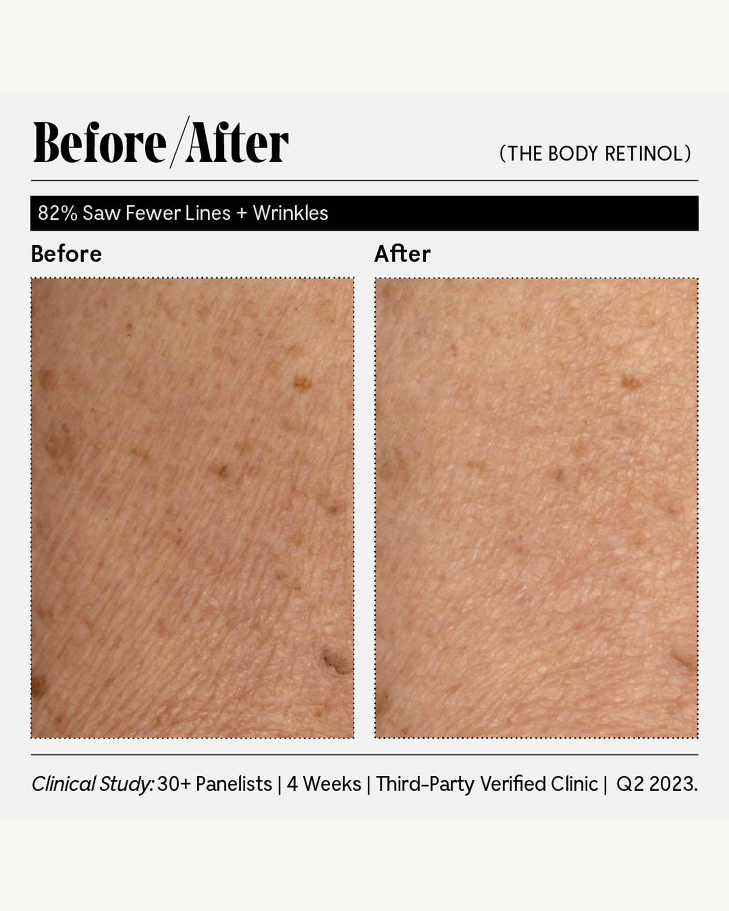 The Body Retinol