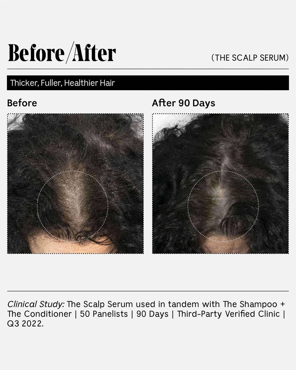Le Sérum Capillaire