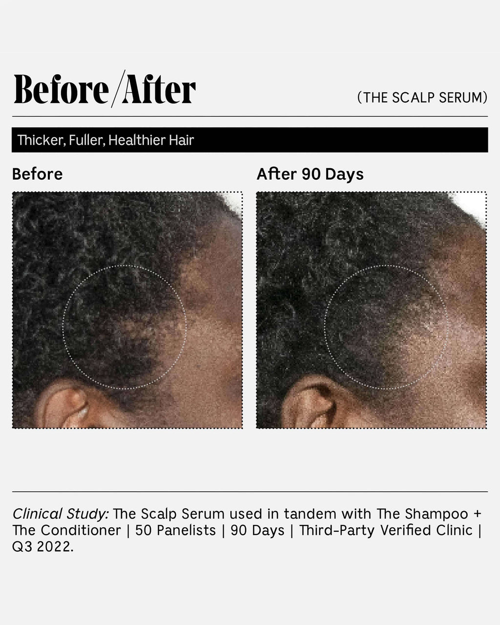 Le Sérum Capillaire