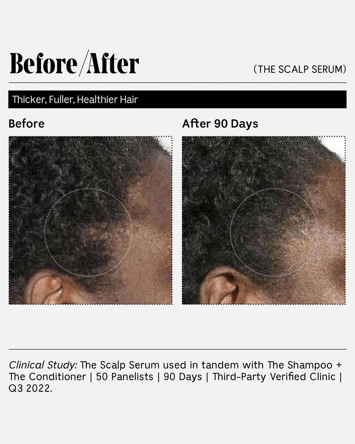 Le Sérum Capillaire