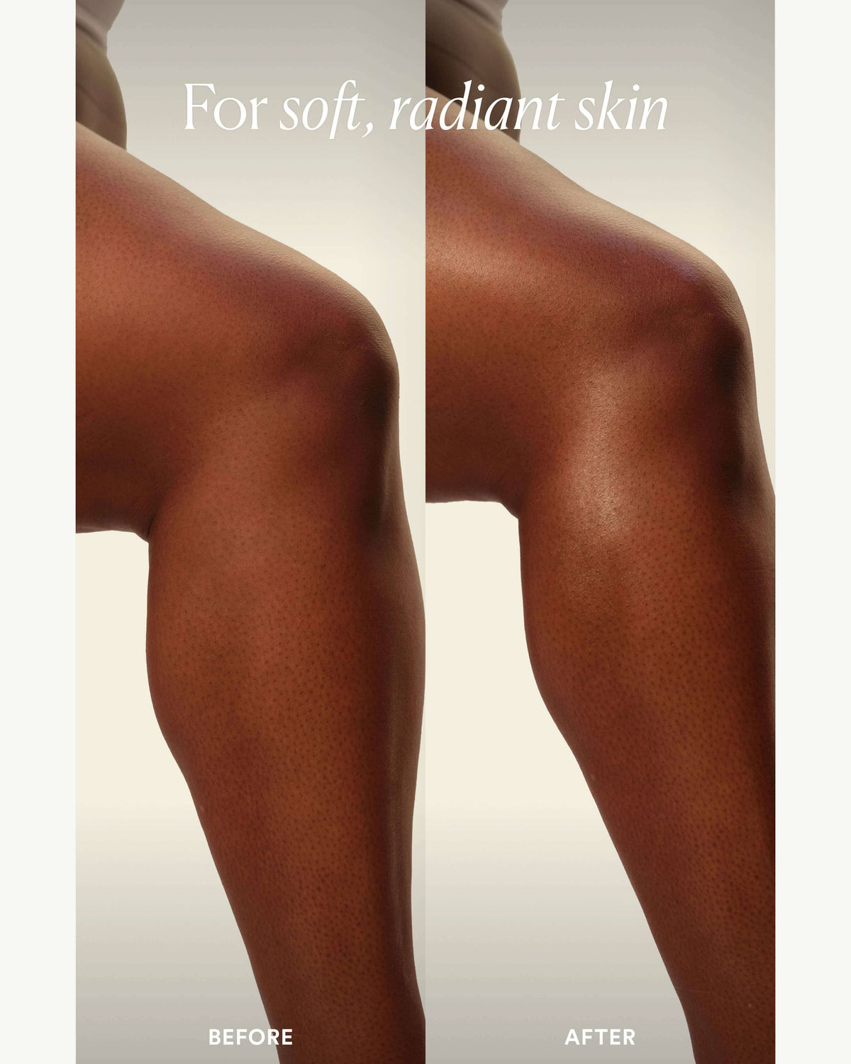 Dream Bio-Retinol Body Serum