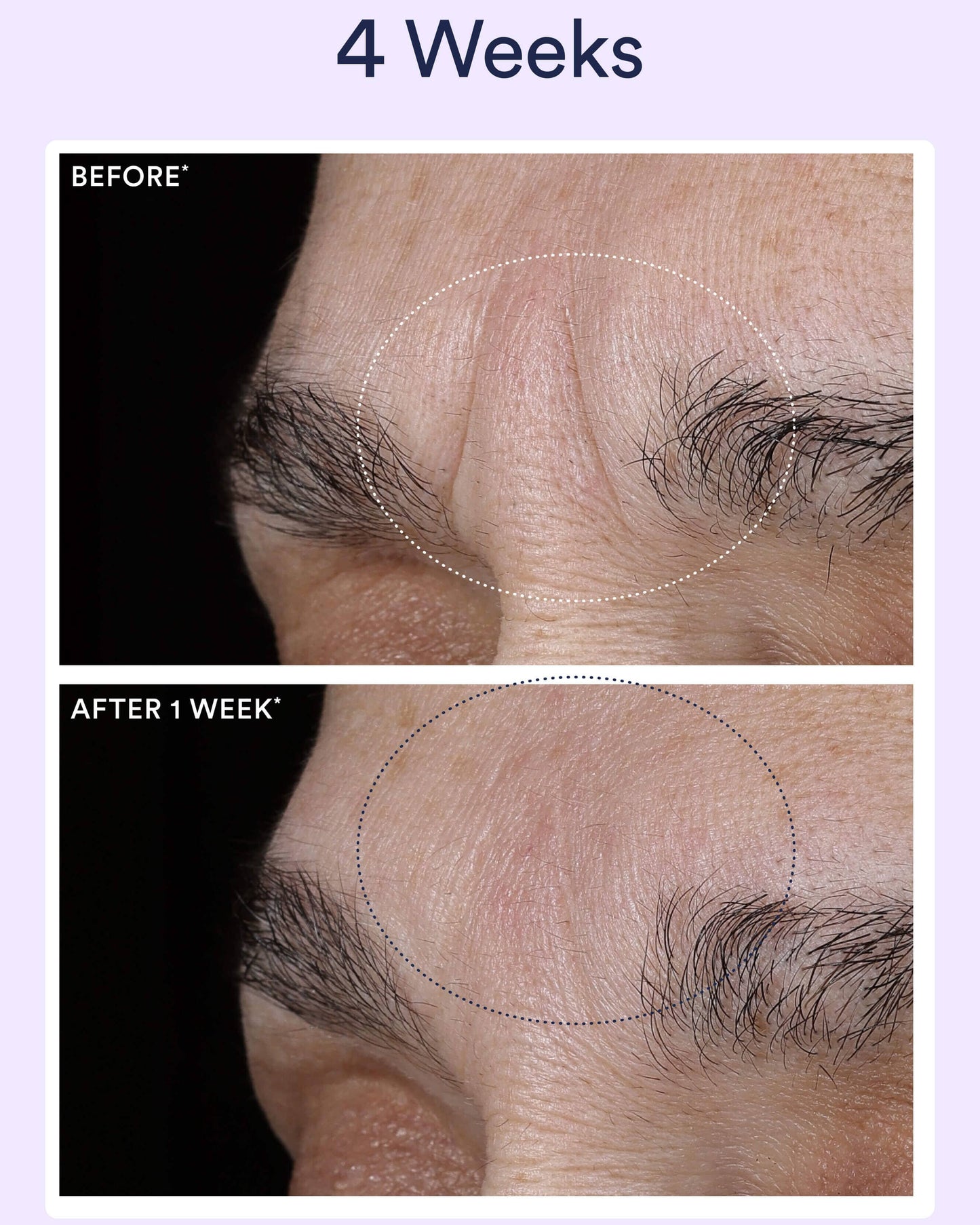 Dream Night Serum with Bio-Retinol
