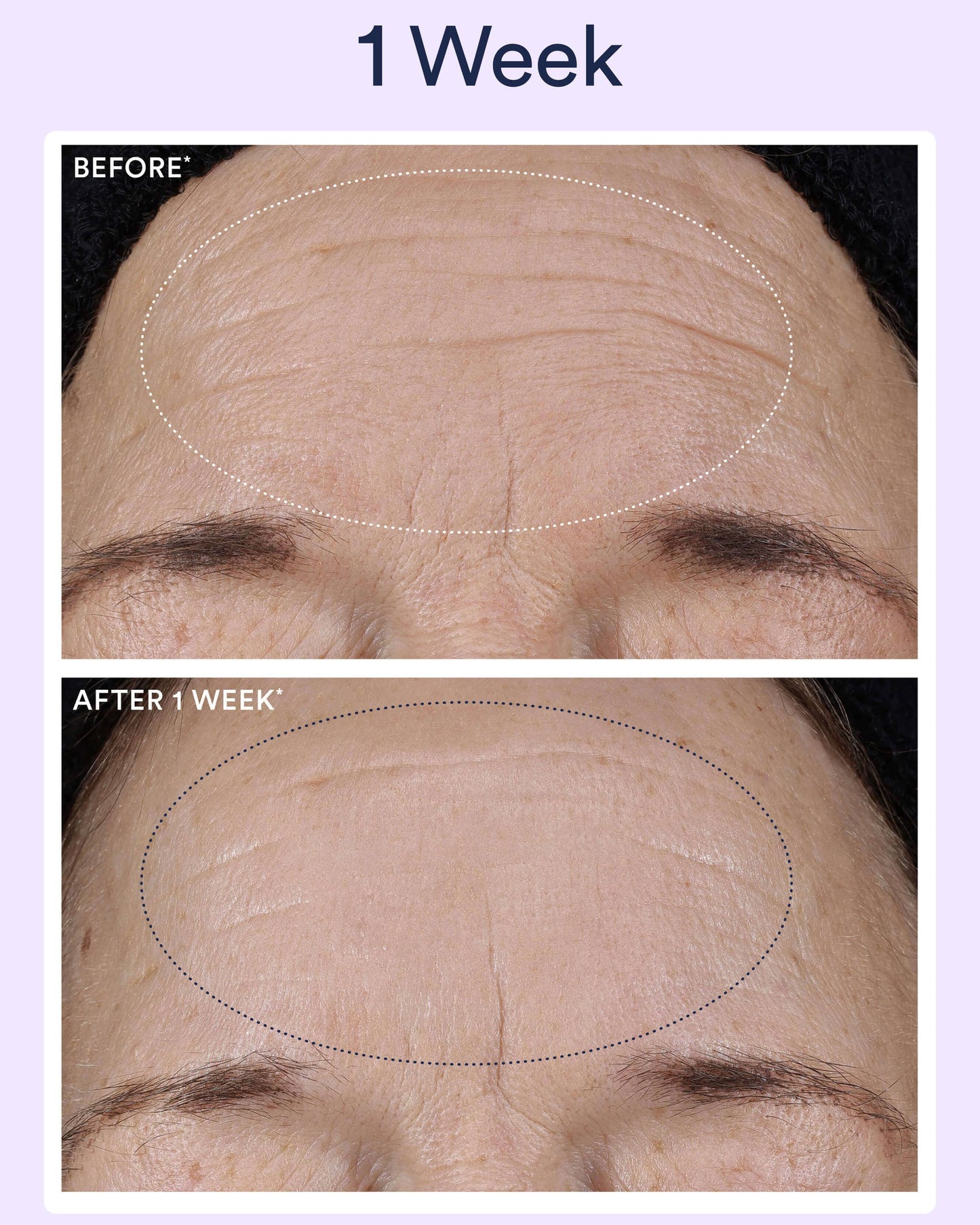 Dream Night Serum with Bio-Retinol