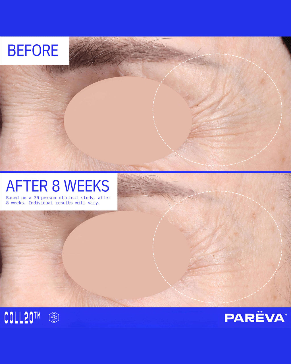 Coll20 Gel Cream Moisturizer