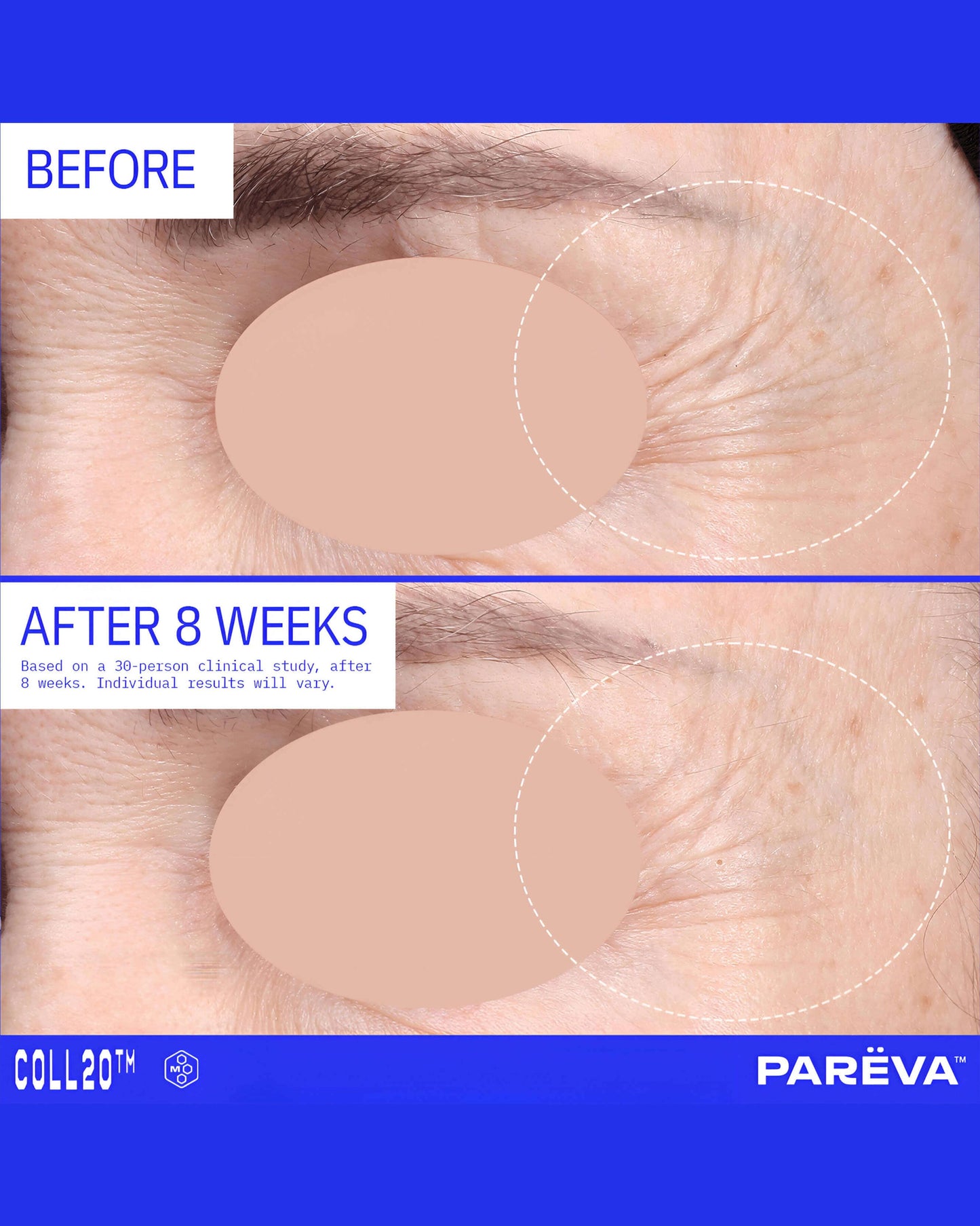 Coll20 Gel Cream Moisturizer