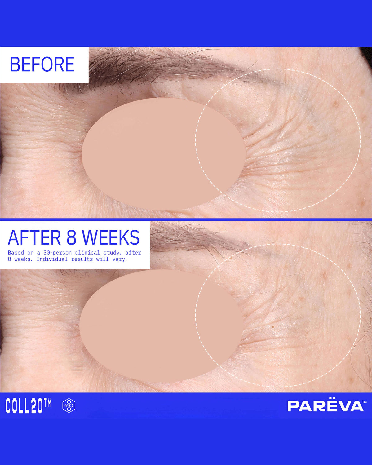 Coll20 Crème Gel Hydratante