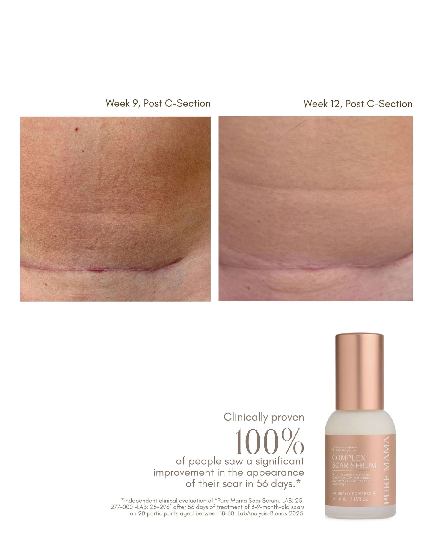Complex Scar Serum