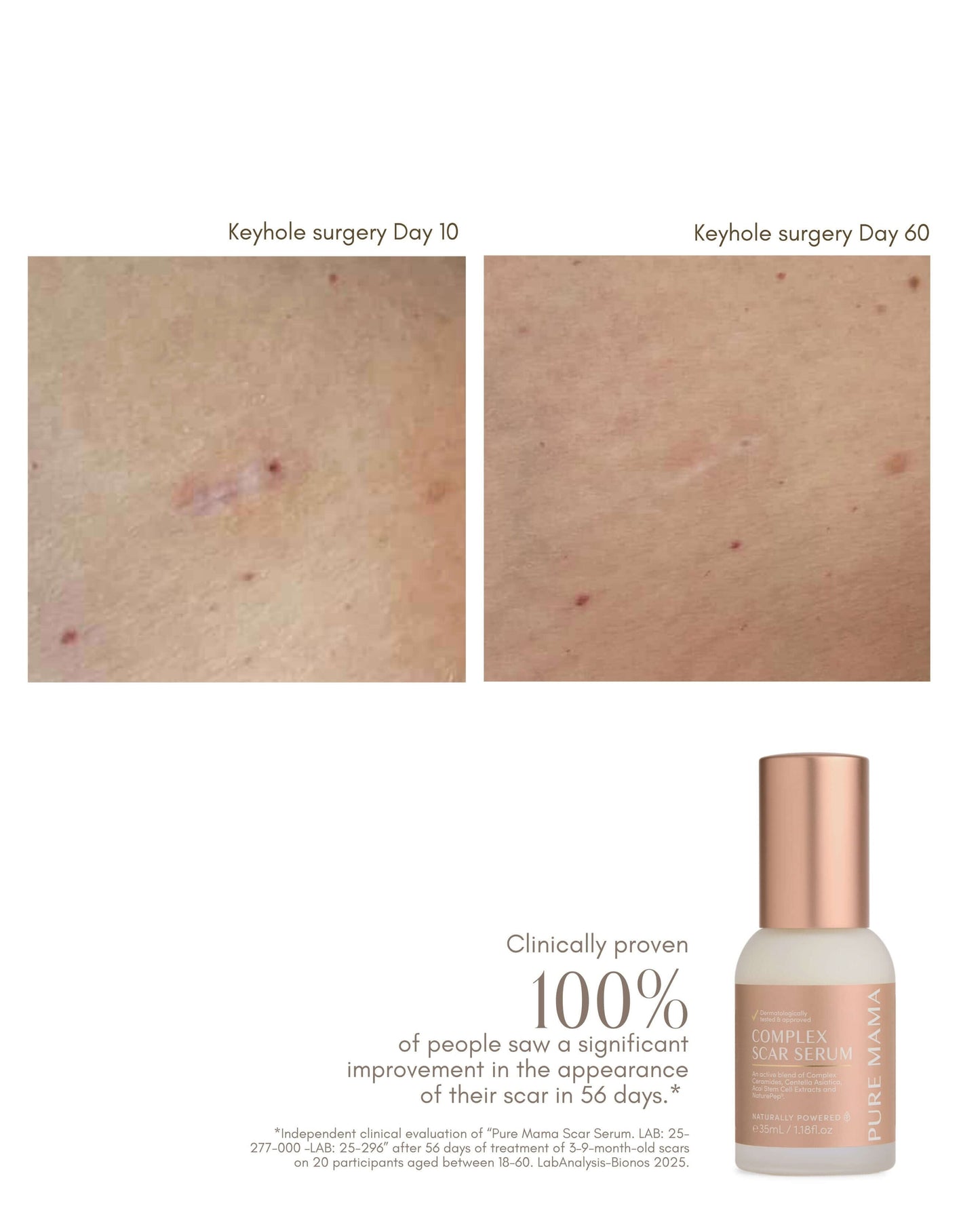 Complex Scar Serum