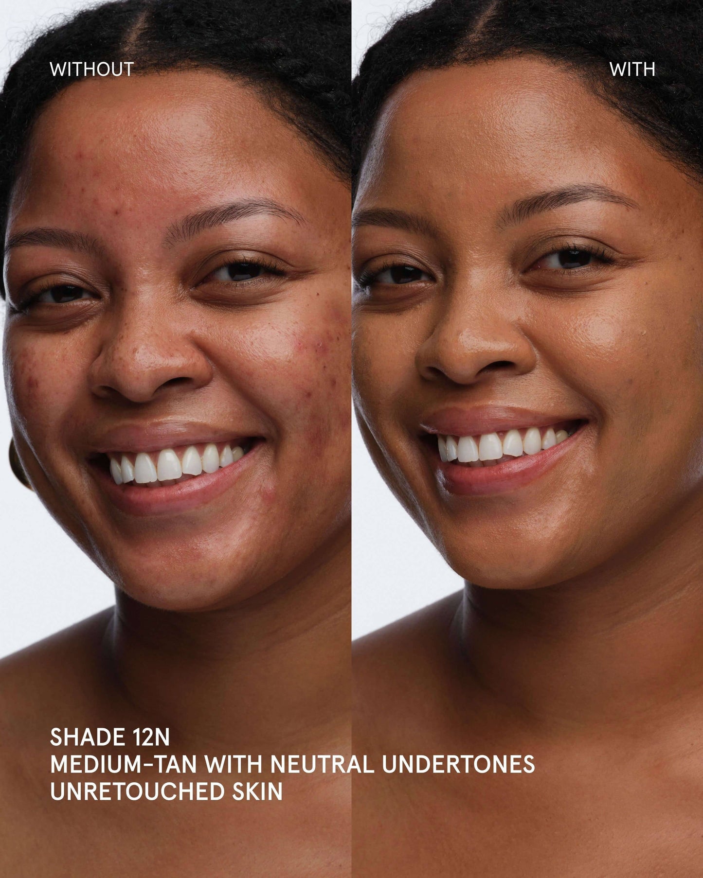 Ectoin Multi-Use Concealer