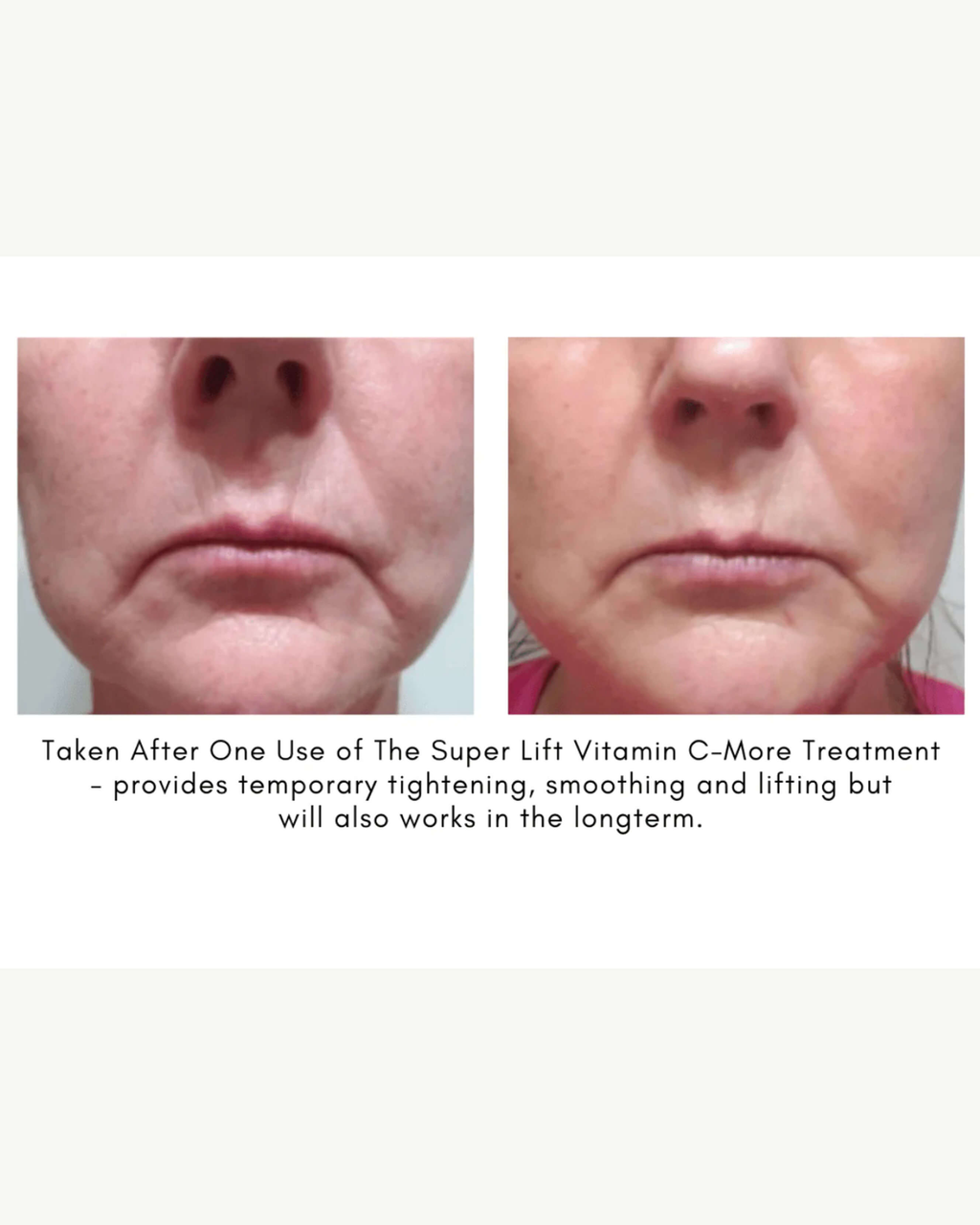 Le Soin Vitamine C-More Super Lift