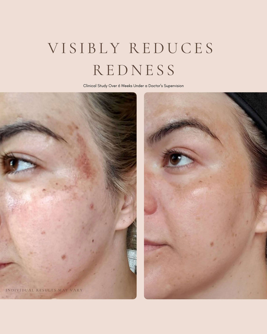 Luxury Beauty Serum