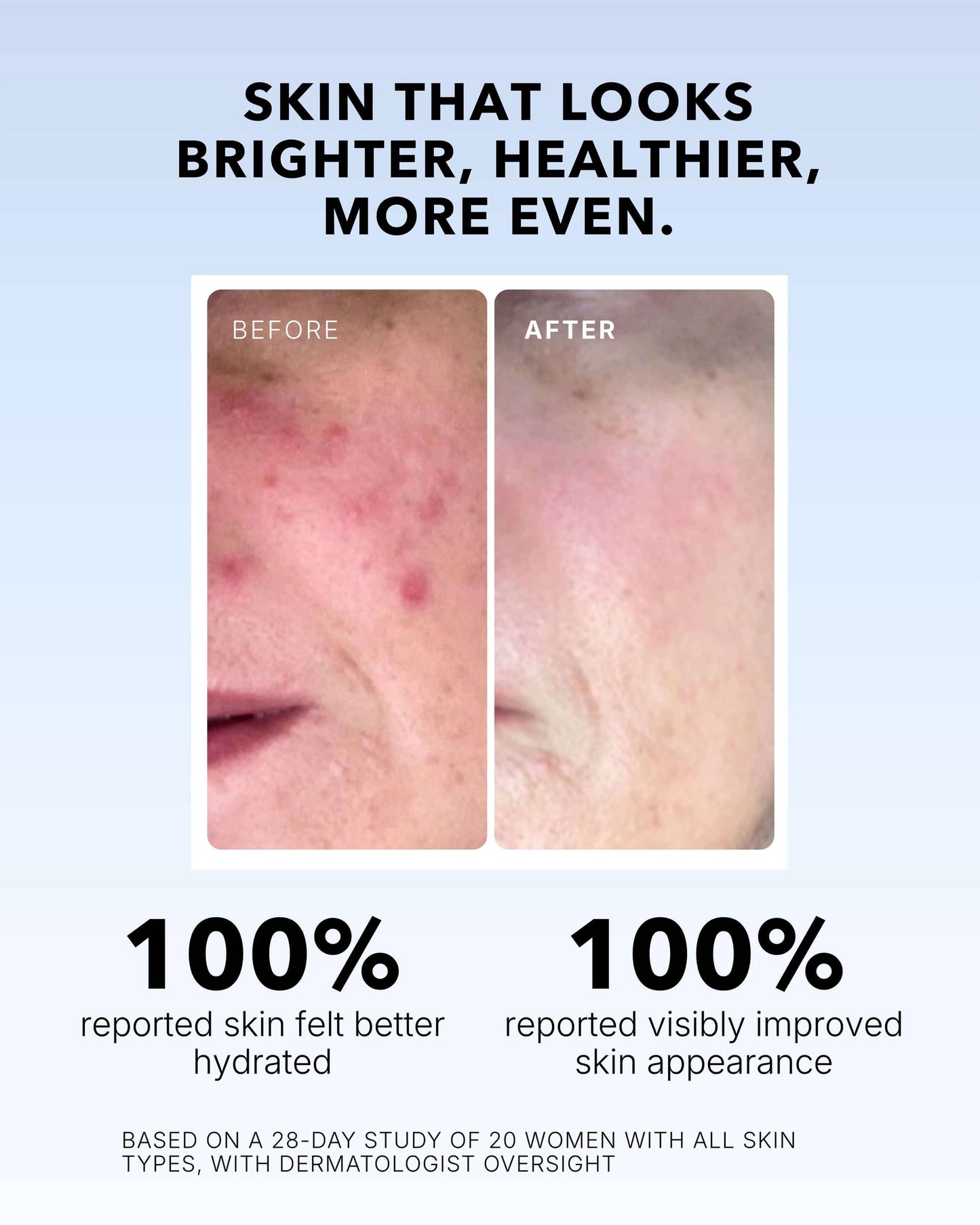 Vitamin C Serum In Oil