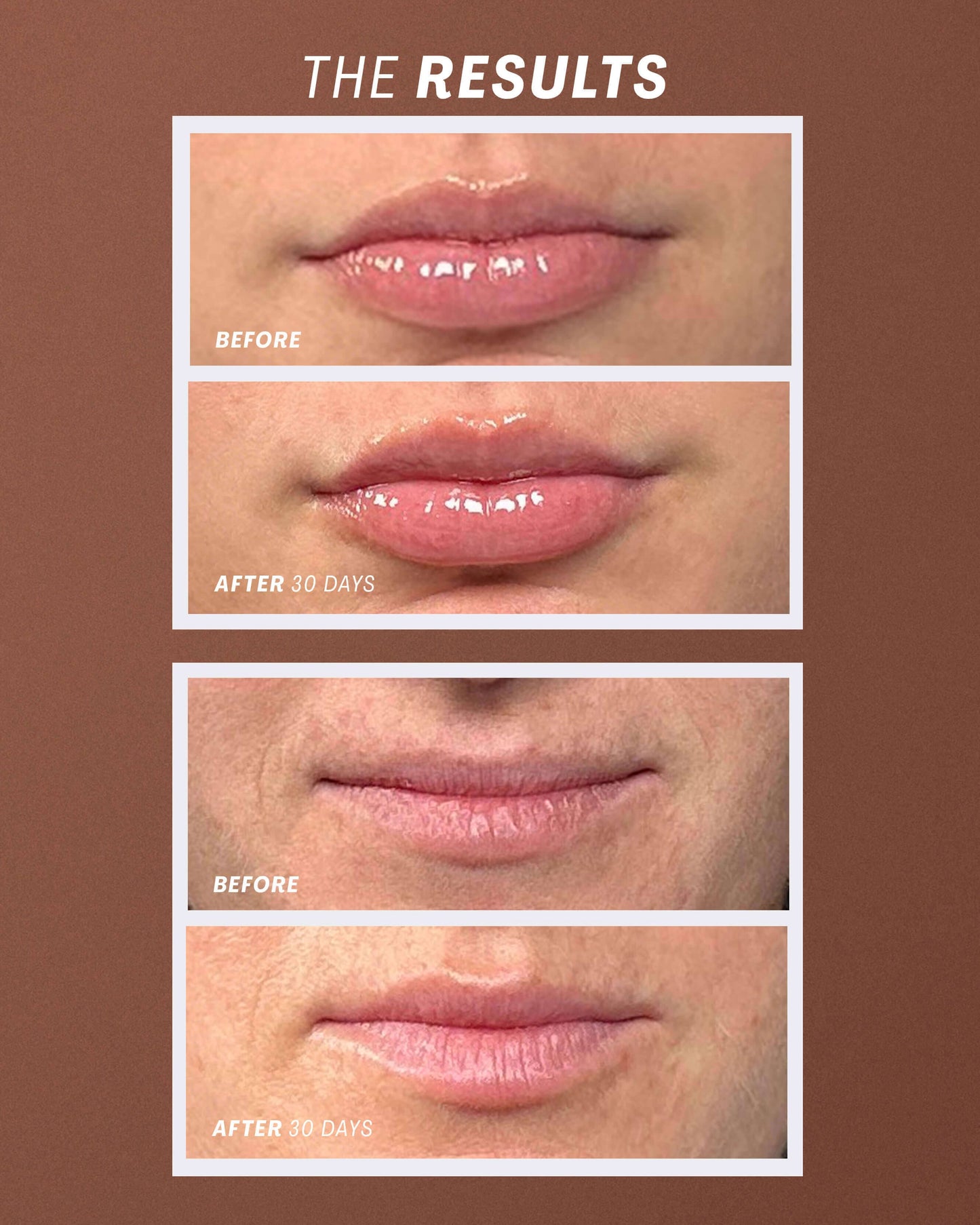 Lip Oasis™️ Glossy Treatment