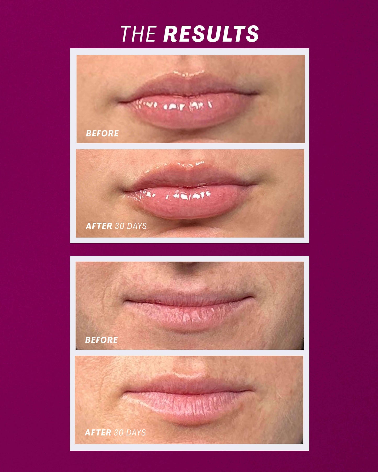Lip Oasis™️ Glossy Treatment