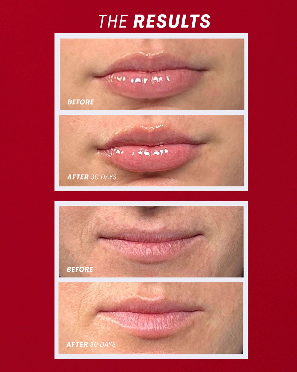 Lip Oasis™️ Glossy Treatment
