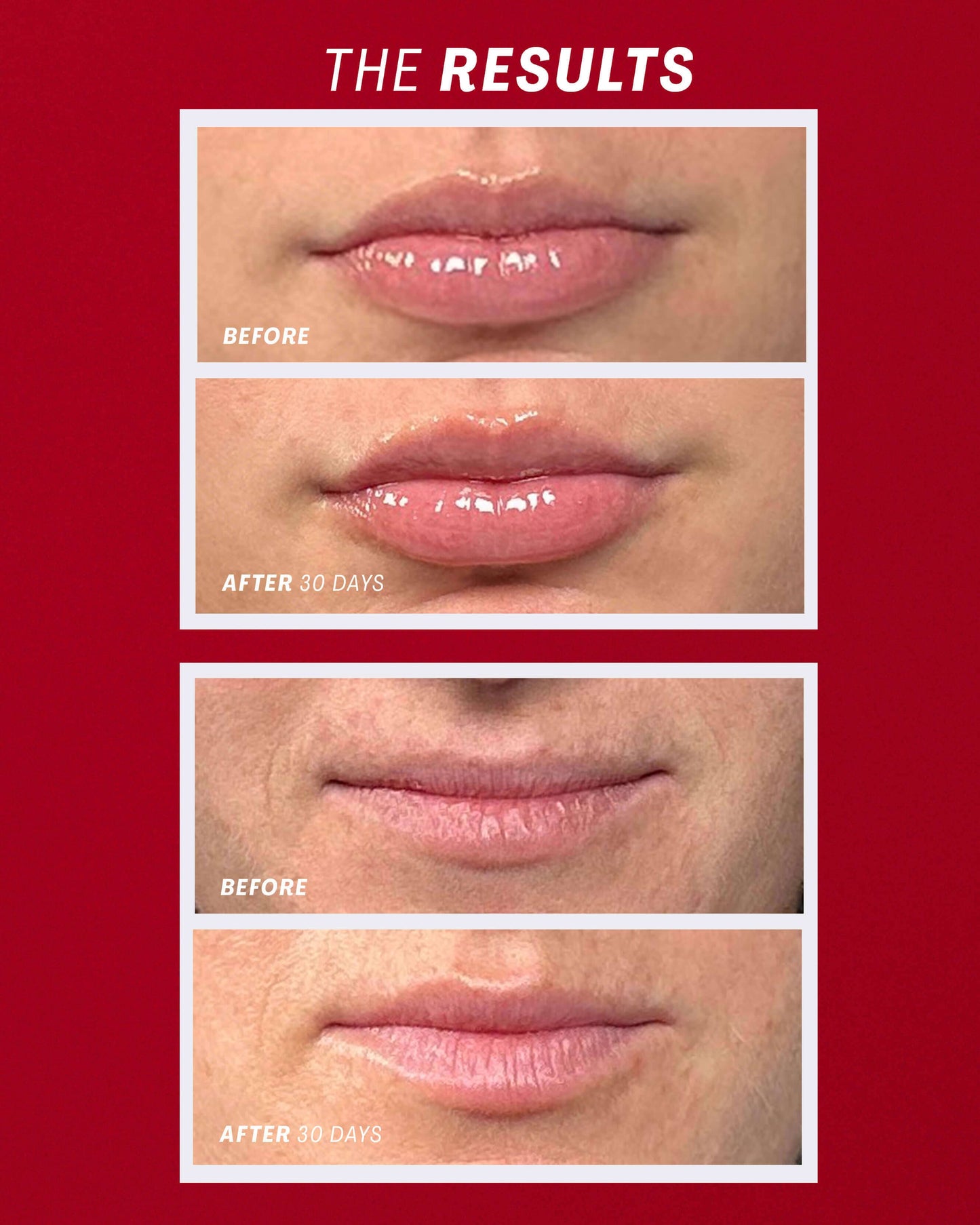 Lip Oasis™️ Glossy Treatment