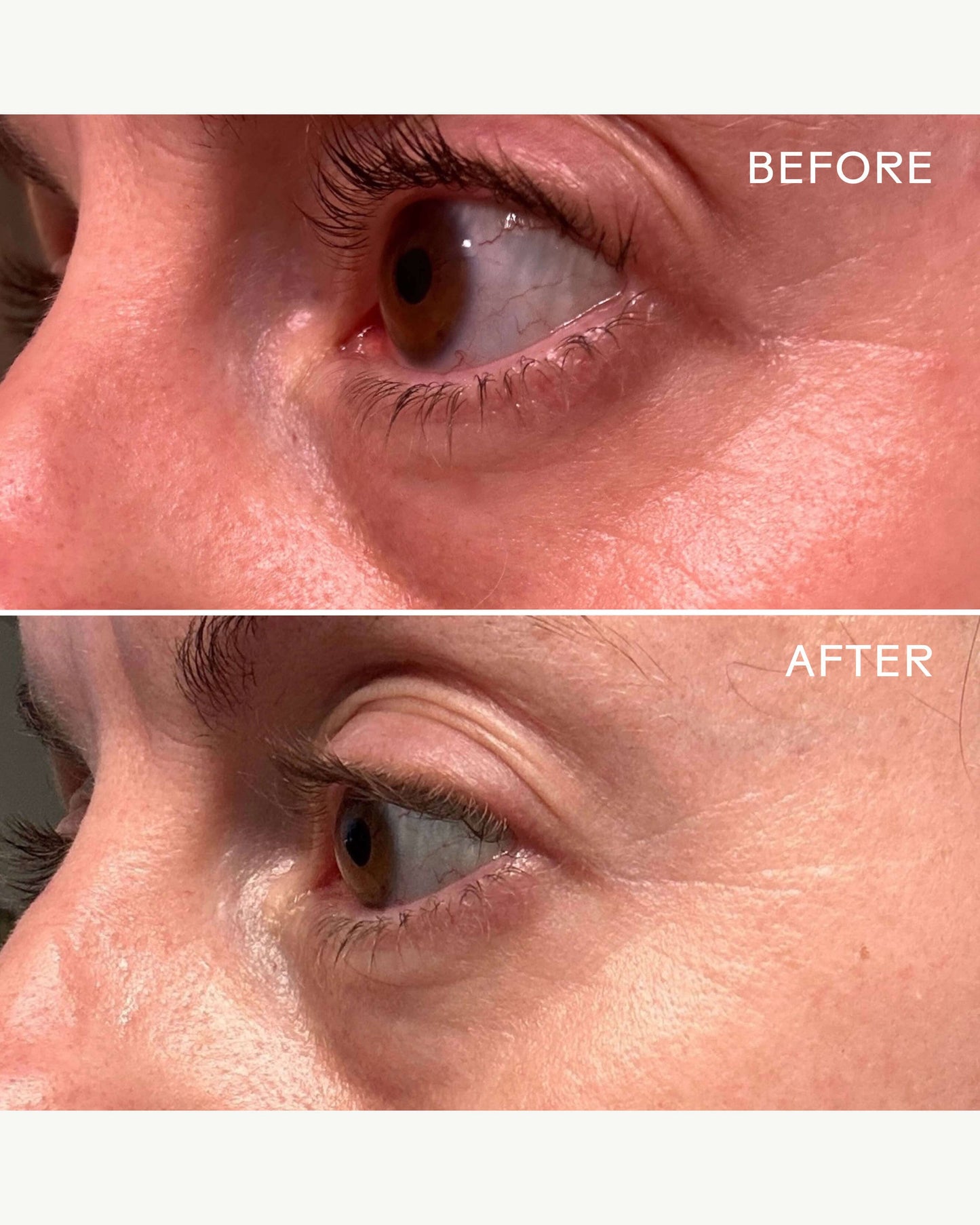 EyeHero™ Bio-Retinol Smoothing Eye Cream