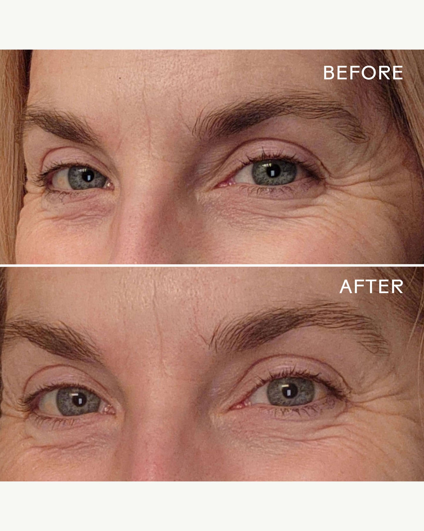 EyeHero™ Bio-Retinol Smoothing Eye Cream