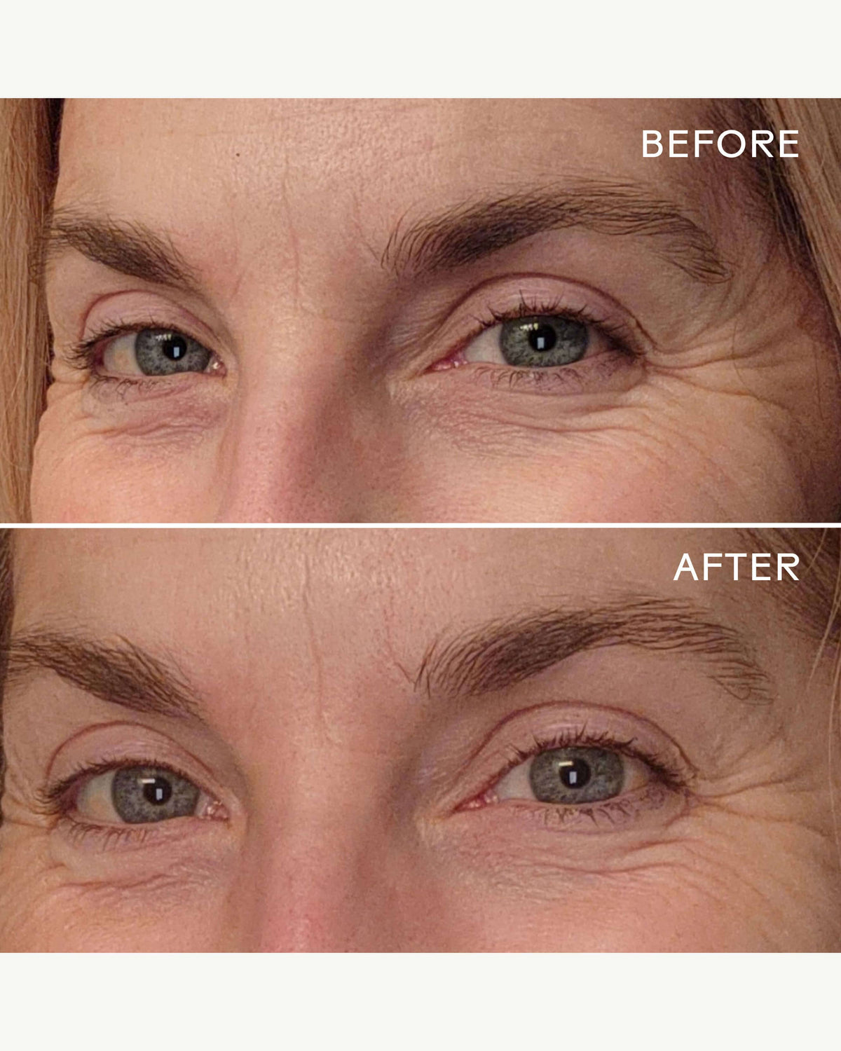 EyeHero™ Bio-Retinol Smoothing Eye Cream