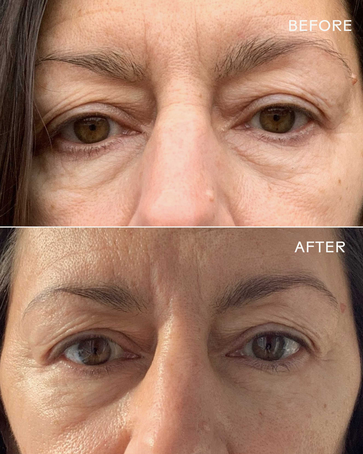 Crème Contour des Yeux à la Vitamine C + Caféine First Light
